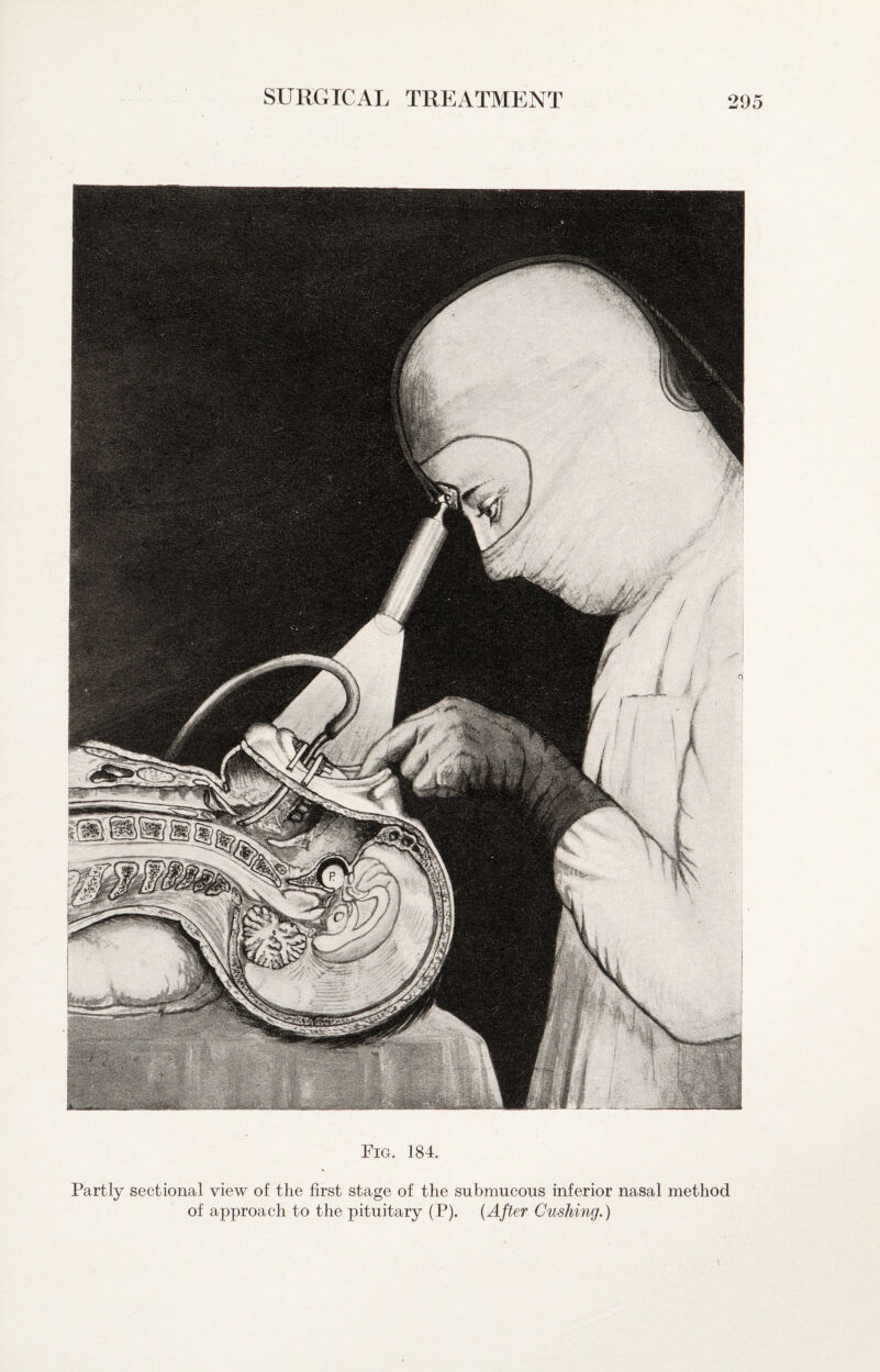 Fig. 184. Partly sectional view of the first stage of the submucous inferior nasal method of approach to the pituitary (P). {After Gushing.)