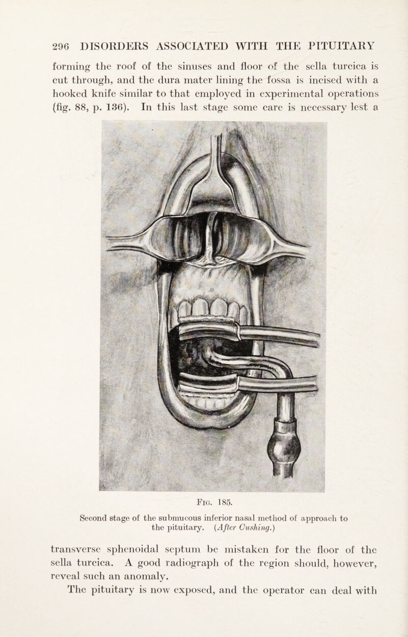 forming the roof of the sinuses and floor of the sella turcica is cut through, and the dura mater lining the fossa is incised with a hooked knife similar to that employed in experimental operations (fig. 88, p. 136). In this last stage some care is necessary lest a Fig. 185. Second stage of the submucous inferior nasal method of approach to the pituitary. {After Cushing.) transverse sphenoidal septum be mistaken for the floor of the sella turcica. A good radiograph of the region should, however, reveal such an anomaly. The pituitary is now exposed, and the operator can deal with