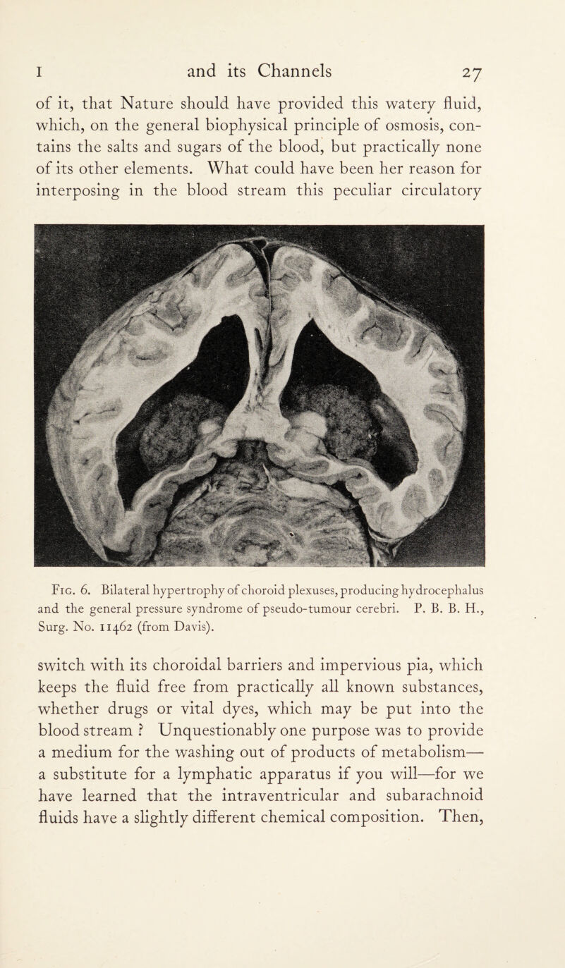 of it, that Nature should have provided this watery fluid, which, on the general biophysical principle of osmosis, con¬ tains the salts and sugars of the blood, but practically none of its other elements. What could have been her reason for interposing in the blood stream this peculiar circulatory Fig. 6. Bilateral hypertrophy of choroid plexuses, producing hydrocephalus and the general pressure syndrome of pseudo-tumour cerebri. P. B. B. H., Surg. No. 11462 (from Davis). switch with its choroidal barriers and impervious pia, which keeps the fluid free from practically all known substances, whether drugs or vital dyes, which may be put into the bloodstream ? Unquestionably one purpose was to provide a medium for the washing out of products of metabolism— a substitute for a lymphatic apparatus if you will—for we have learned that the intraventricular and subarachnoid fluids have a slightly different chemical composition. Then,