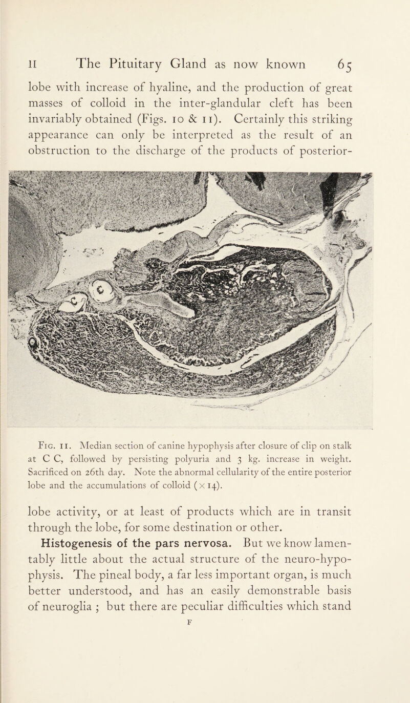 lobe with increase of hyaline, and the production of great masses of colloid in the inter-glandular cleft has been invariably obtained (Figs. 10 & 11). Certainly this striking appearance can only be interpreted as the result of an obstruction to the discharge of the products of posterior- Fig. 11. Median section of canine hypophysis after closure of clip on stalk at C C, followed by persisting polyuria and 3 kg. increase in weight. Sacrificed on 26th day. Note the abnormal cellularity of the entire posterior lobe and the accumulations of colloid (X14). lobe activity, or at least of products which are in transit through the lobe, for some destination or other. Histogenesis of the pars nervosa. But we know lamen¬ tably little about the actual structure of the neuro-hypo¬ physis. The pineal body, a far less important organ, is much better understood, and has an easily demonstrable basis of neuroglia ; but there are peculiar difficulties which stand F