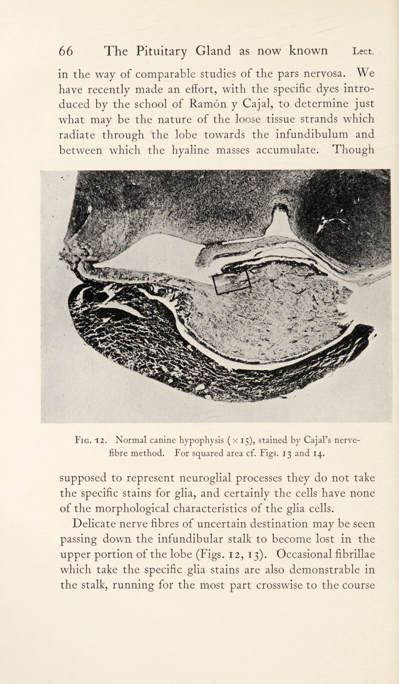 in the way of comparable studies of the pars nervosa. We have recently made an effort, with the specific dyes intro¬ duced by the school of Ramon y Cajal, to determine just what may be the nature of the loose tissue strands which radiate through the lobe towards the infundibulum and between which the hyaline masses accumulate. Though Fig. -12. Normal canine hypophysis (x 15), stained by Cajal’s nerve- fibre method. For squared area cf. Figs. 13 and 14. supposed to represent neuroglial processes they do not take the specific stains for glia, and certainly the cells have none of the morphological characteristics of the glia cells. Delicate nerve fibres of uncertain destination may be seen passing down the infundibular stalk to become lost in the upper portion of the lobe (Figs. 12, 13). Occasional fibrillae which take the specific glia stains are also demonstrable in the stalk, running for the most part crosswise to the course