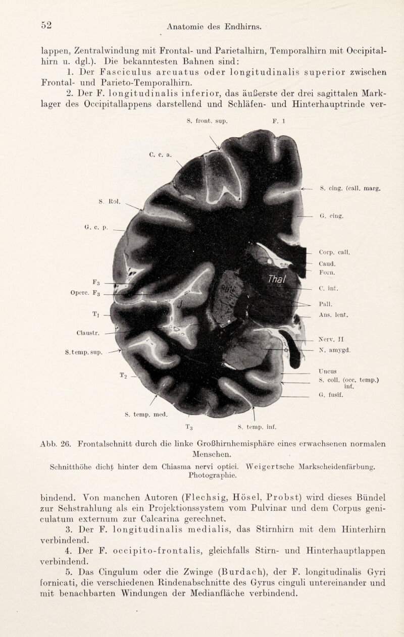 lappen, Zentralwindung mit Frontal- und Parietalhirn, Temporalhirn mit Occipital- hirn u. dgh). Die bekanntesten Bahnen sind: 1. Der Fasciculus arcuatus oder longitudinalis superior zwischen Frontal- und Parieto-Temporalhirn. 2. Der F. longitudinalis inferior, das äußerste der drei sagittalen Mark¬ lager des Occipitallappens darstellend und Schläfen- und Hinterhauptrinde ver- S. front, sup. F. 1 S. temp. inf. Operc. F3 Claustr. S.temp. sup. S. temp. med. S. cing. (call, marg. G-. cing. Corp. call. Caud. Füiii. C. int. Pall. Ans. lent. Xerv. JI X. aniygd. Uncus S. coli. (occ. temp.) inf. G. fusif. Abb. 26. Frontalschnitt durch die linke Großhirnhemisphäre eines erwachsenen normalen Menschen. Schnitthöhe dicht hinter dem Chiasma nervi oj^tici. Weigertsche Markscheidenfärbung. Photographie. bindend. Von manchen Autoren (Flechsig, Hösel, Probst) wird dieses Bündel zur Sehstrahlung als ein Projektionssystem vom Pulvinar und dem Corpus geni- culatum externum zur Calcarina gerechnet. 3. Der F. longitudinalis medialis, das Stirnhirn mit dem Hinterhirn verbindend. 4. Der F. occipito-frontalis, gleichfalls Stirn- und Hinterhauptlappen verbindend. 5. Das Cingulum oder die Zwinge (Burdach), der F. longitudinalis Gyri fornicati, die verschiedenen Bindenabschnitte des Gyrus cinguli untereinander und mit benaehbarten Windungen der Medianfläche verbindend.