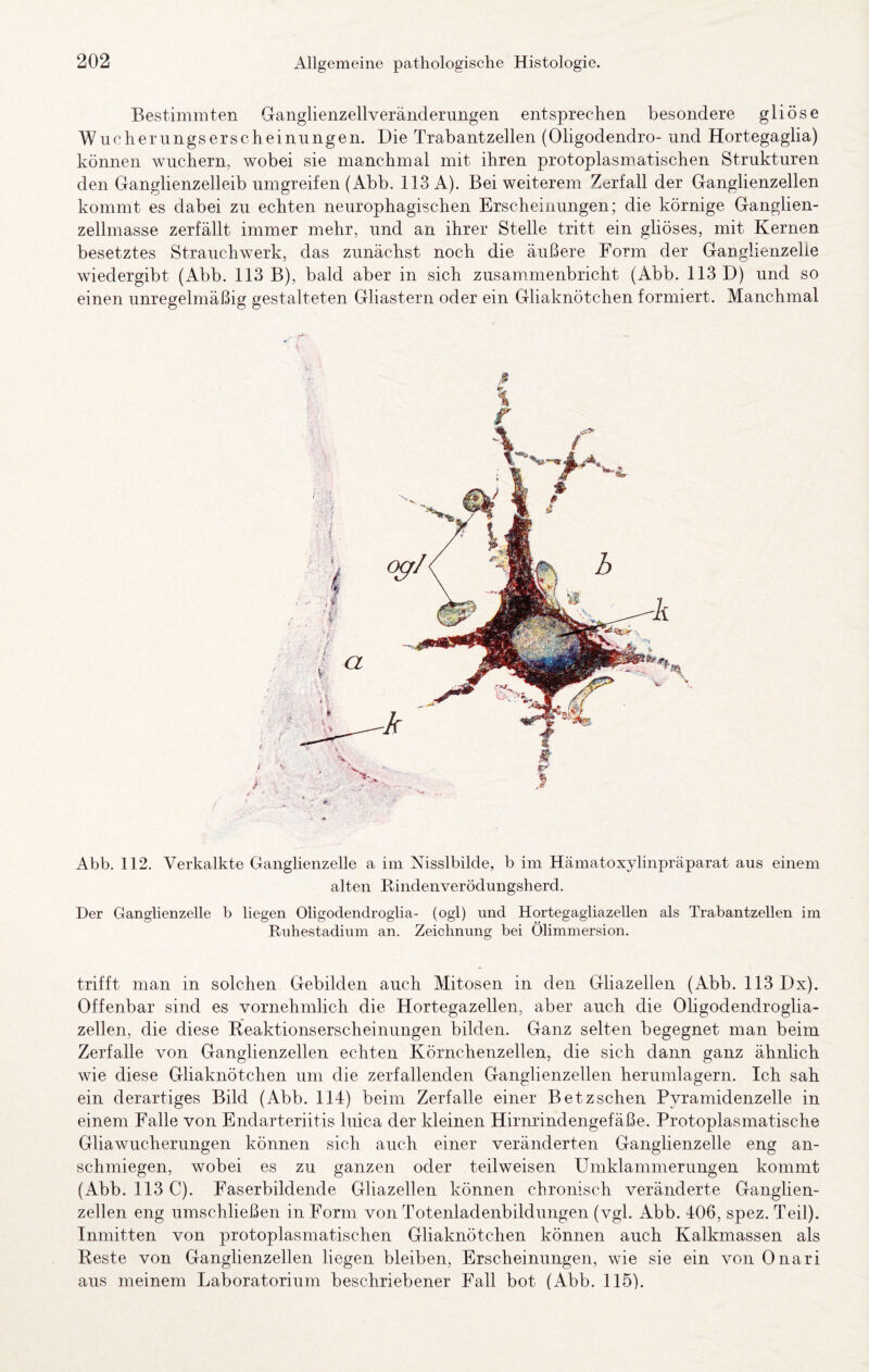 Bestimmten Ganglienzellveränclerungen entsprechen besondere gliöse Wucherungserscheinungen. Die Trabantzellen (Oligodendro- und Hortegaglia) können wuchern, wobei sie manchmal mit ihren protoplasm.atischen Strukturen den Ganglienzeileib umgreifen (Abb. 113 A). Bei weiterem Zerfall der Ganglienzellen kommt es dabei zu echten neurophagischen Erscheinungen; die körnige Ganglien¬ zellmasse zerfällt immer mehr, und an ihrer Stelle tritt ein gliöses, mit Kernen besetztes Strauchwerk, das zunächst noch die äußere Form der Ganglienzelie wiedergibt (Abb. 113 B), bald aber in sich zusammenbricht (Abb. 113 D) und so einen unregelmäßig gestalteten Gliastern oder ein Gliaknötchen formiert. Manchmal Abb. 112. Verkalkte Ganglienzelle a im Nisslbilde, b im Hämatoxylinpräparat aus einem alten Rindenverödungsherd. Der Ganglienzelle b liegen Oligodendroglia- (ogl) und Hortegagliazellen als Trabantzellen im Ruhestadium an. Zeichnung bei Ölimmersion. trifft man in solchen Gebilden auch Mitosen in den Gliazellen (Abb. 113 Dx). Offenbar sind es vornehmlich die Hortegazellen, aber auch die Ohgodendroglia- zellen, die diese Reaktionserscheinungen bilden. Ganz selten begegnet man beim Zerfalle von Ganglienzellen echten Körnchenzellen, die sich dann ganz ähnlich wie diese Gliaknötchen um die zerfallenden Ganglienzellen herumlagern. Ich sah ein derartiges Bild (Abb. 114) beim Zerfalle einer Betzschen Pyramidenzelle in einem Falle von Endarteriitis luica der kleinen Hirnrindengefäße. Protoplasmatische Gliawucherungen können sich auch einer veränderten Ganglienzelle eng an¬ schmiegen, wobei es zu ganzen oder teilweisen Umklammerungen kommt (Abb. 113 C). Faserbildende Gliazellen können chronisch veränderte Ganglien¬ zellen eng umschließen in Form von Totenladenbildungen (vgl. Abb. 406, spez. Teil). Inmitten von protoplasmatischen Gliaknötchen können auch Kalkmassen als Reste von Ganglienzellen liegen bleiben, Erscheinungen, wie sie ein von Onari aus meinem Laboratorium beschriebener Fall bot (Abb. 115).