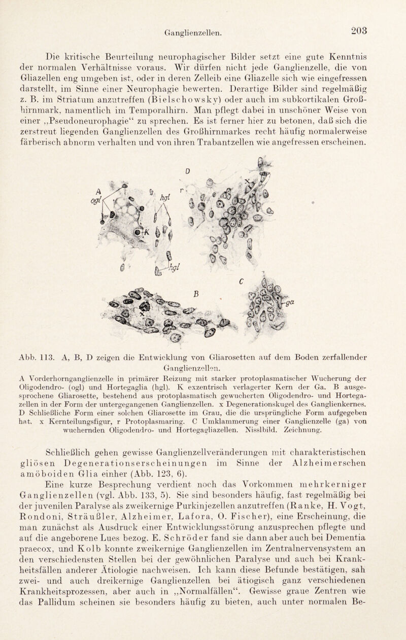 Die kritische Beurteilung neurophagischer Bilder setzt eine gute Kenntnis der normalen Verhältnisse voraus. Wir dürfen nicht jede Ganglienzelle, die von Gliazellen eng umgeben ist, oder in deren Zelleib eine Gliazelle sich wie eingefressen darstellt, im Sinne einer Neurophagie bewerten. Derartige Bilder sind regelmäßig z. B. im Striatum anzutreffen (Bielschowsky) oder auch im subkortikalen Groß¬ hirnmark, namentlich im Temporalhirn. Man pflegt dabei in unschöner Weise von einer ,,Pseudoneurophagie“ zu sprechen. Es ist ferner hier zu betonen, daß sich die zerstreut liegenden Ganglienzellen des Großhirnmarkes recht häufig normalerweise färberisch abnorm verhalten und von ihren Trabantzellen wie angefressen erscheinen. Abb. 113. A, B, D zeigen die Entwicklung von Gliarosetten auf dem Boden zerfallender Ganglienzellen. A Vorderhornganglienzelle in primärer Reizung mit starker protoplasmatischer Wucherung der Oligodendro- (ogl) und Hortegaglia (hgl). K exzentrisch verlagerter Kern der Ga. B ausge¬ sprochene Gliarosette, bestehend aus protoplasmatisch gewucherten Oligodendro- und Hortega¬ zellen in der Form der untergegangenen Ganglienzellen, x Degenerationskugel des Ganglienkernes. D Schließliche Form einer solchen Gliarosette im Grau, die die ursprüngliche Form aufgegeben hat. X Kernteilungsfigur, r Protoplasmaring. C Umklammerung einer Ganglienzelle (ga) von wuchernden Oligodendro- und Hortegagliazellen. Nisslbild. Zeichnung. Schließlich gehen gewisse Ganglienzellveränderungen mit charakteristischen gliösen Degenerationserscheinungen im Sinne der Alzheimerschen amöboiden Glia einher (Abb. 123, 6). Eine kurze Besprechung verdient noch das Vorkommen mehr kernig er Ganglienzellen (vgl. Abb. 133, 5). Sie sind besonders häufig, fast regelmäßig bei der juvenilen Paralyse als zweikernige Purkinjezellen anzutreffen (Kanke, H. Vo Pondoni, Sträußler, Alzheimer, Lafora, 0. Fischer), eine Erscheinung, die man zunächst als Ausdruck einer Entwicklungsstörung anzusprechen pflegte und auf die angeborene Lues bezog. E. Schröder fand sie dann aber auch bei Dementia praecox, und Kolb konnte zweikernige Ganglienzellen im Zentralnervensystem an den verschiedensten Stellen bei der gewöhnlichen Paralyse und auch bei Krank¬ heitsfällen anderer Ätiologie nachweisen. Ich kann diese Befunde bestätigen, sah zwei- und auch dreikernige Ganglienzellen bei ätiogisch ganz verschiedenen Krankheitsprozessen, aber auch in ,,Normalfällen“. Gewisse graue Zentren wie das Pallidum scheinen sie besonders häufig zu bieten, auch unter normalen Be-