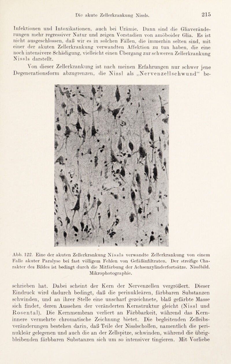Die akute Zellerkrankunfir Nissls. o 215 Infektionen und Intoxikationen, auch bei Urämie. Dann sind die Gliaverände- rnngen mehr regressiver Natur und zeigen Vorstadien von amöboider Glia. Es ist nicht ausgeschlossen, daß wir es in solchen Fällen, die immerhin selten sind, mit einer der akuten Zellerkranknng verwandten Affektion zu tun haben, die eine noch intensivere Schädigung, vielleicht einen Übergang zur schweren Zellerkrankung Nissls darstellt. Von dieser Zellerkranknng ist nach meinen Erfahrungen nur schwer jene Degenerationsform abzugrenzen, die Nissl als ,,Nervenzellschwund‘' be- Abb. 122. Eine der akuten Zellerkrankung Nissls verwandte Zellerkrankung von einem Falle akuter Paralyse bei fast völligem Fehlen von Gefäßinfiltraten, Der streifige Cha¬ rakter des Bildes ist bedingt durch die Mitfärbung der Achsenzylinderfortsätze. Nisslbild. Mikrophotographie. schrieben hat. Dabei scheint der Kern der Nervenzellen vergrößert. Dieser Eindruck wird dadurch bedingt, daß die perinukleären, färbbaren Substanzen schwinden, und an ihrer Stelle eine unscharf gezeichnete, blaß gefärbte Masse sich findet, deren Aussehen der veränderten Kernstruktur gleicht (Nissl und Rosental). Die Kernmembran verliert an Färbbarkeit, während das Kern¬ innere vermehrte chromatische Zeichnung bietet. Die begleitenden Zelleibs¬ veränderungen bestehen darin, daß Teile der Nisslschollen, namenthch die peri¬ nukleär gelegenen und auch die an der Zellspitze, schwinden, während die übrig¬ bleibenden färbbaren Substanzen sich um so intensiver tingieren. Mit Vorliebe