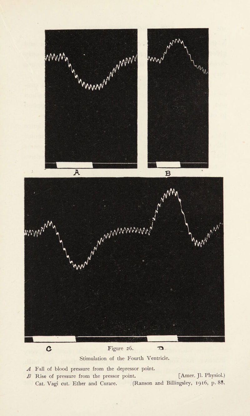 Q. Figure 26. Stimulation of the P'ourth Ventricle. A Fall of blood pressure from the depressor point. B Rise of pressure from the pressor point. [Amer. Jl. Physiol.) Cat. Vagi cut. Ether and Curare. (Ranson and Billingsley, 1916, p. 88.