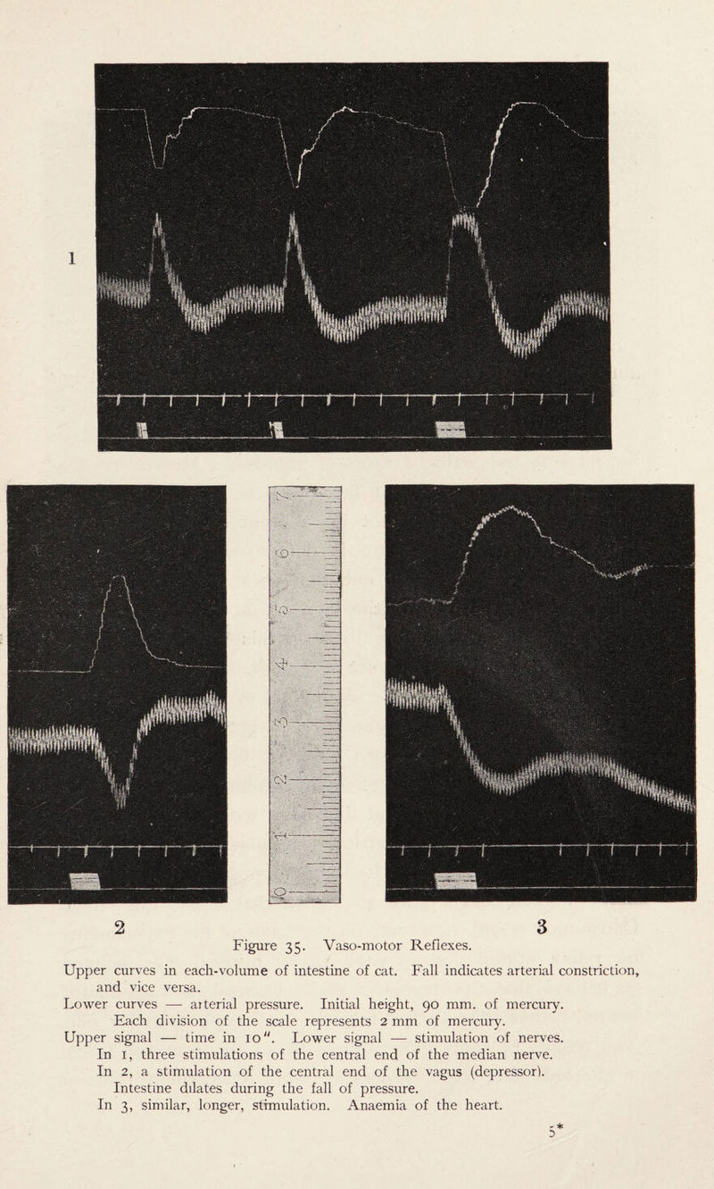 Figure 35. Yaso-motor Reflexes. Upper curves in each-volume of intestine of cat. Fall indicates arterial constriction, and vice versa. Lower curves — arterial pressure. Initial height, 90 mm. of mercury. Each division of the scale represents 2 mm of mercury. Upper signal — time in 1011. Lower signal — stimulation of nerves. In 1, three stimulations of the central end of the median nerve. In 2, a stimulation of the central end of the vagus (depressor). Intestine dilates during the fall of pressure. In 3, similar, longer, stimulation. Anaemia of the heart. - * D