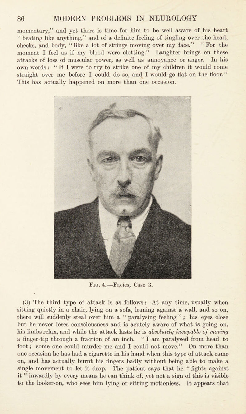 momentary,” and yet there is time for him to be well aware of his heart “ beating like anything,” and of a definite feeling of tingling over the head, cheeks, and body, “ like a lot of strings moving over my face.” “ For the moment I feel as if my blood were clotting.” Laughter brings on these attacks of loss of muscular power, as well as annoyance or anger. In his own words : “If I were to try to strike one of my children it would come straight over me before I could do so, and I would go flat on the floor.” This has actually happened on more than one occasion. Fig. 4.—Facies, Case 3. (3) The third type of attack is as follows: At any time, usually when sitting quietly in a chair, lying on a sofa, leaning against a wall, and so on, there will suddenly steal over him a “ paralysing feeling ” ; his eyes close but he never loses consciousness and is acutely aware of what is going on, his limbs relax, and while the attack lasts he is absolutely incapable of moving a finger-tip through a fraction of an inch. “ I am paralysed from head to foot; some one could murder me and I could not move.” On more than one occasion he has had a cigarette in his hand when this type of attack came on, and has actually burnt his fingers badly without being able to make a single movement to let it drop. The patient says that he “ fights against it ” inwardly by every means he can think of, yet not a sign of this is visible to the looker-on, who sees him lying or sitting motionless, It appears that