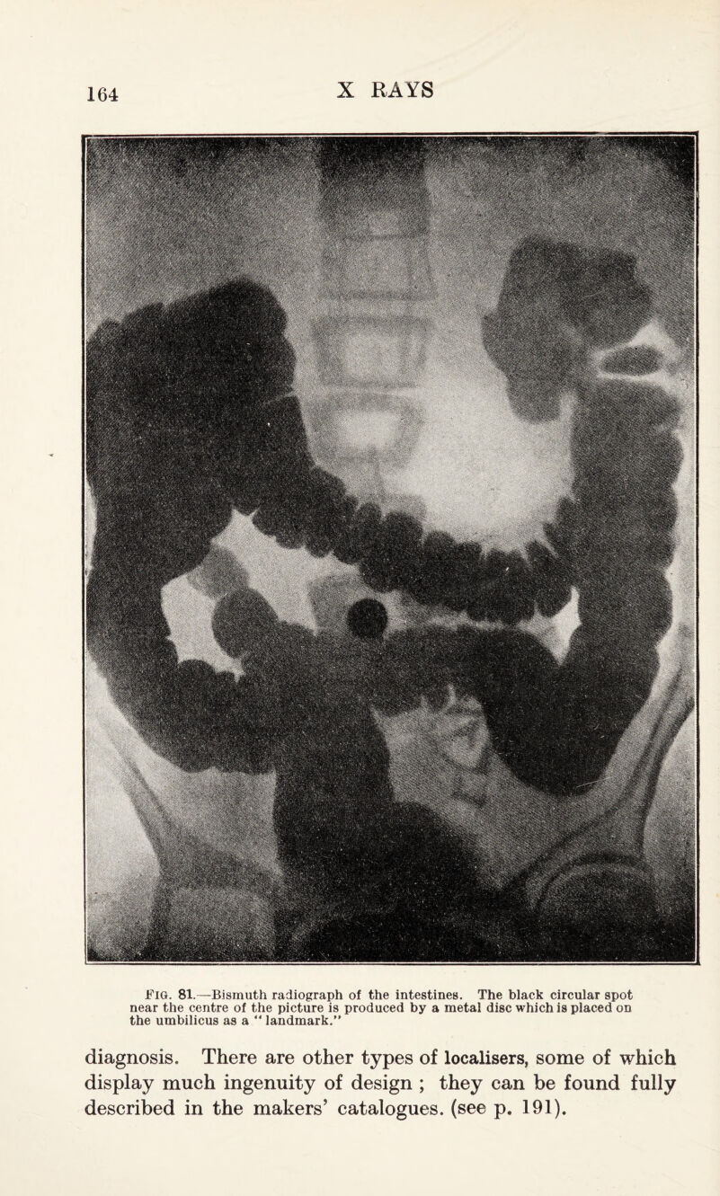 Fig. 81.—Bismuth radiograph of the intestines. The black circular spot near the centre of the picture is produced by a metal disc which is placed on the umbilicus as a “ landmark.” diagnosis. There are other types of localisers, some of which display much ingenuity of design ; they can be found fully described in the makers’ catalogues, (see p. 191).