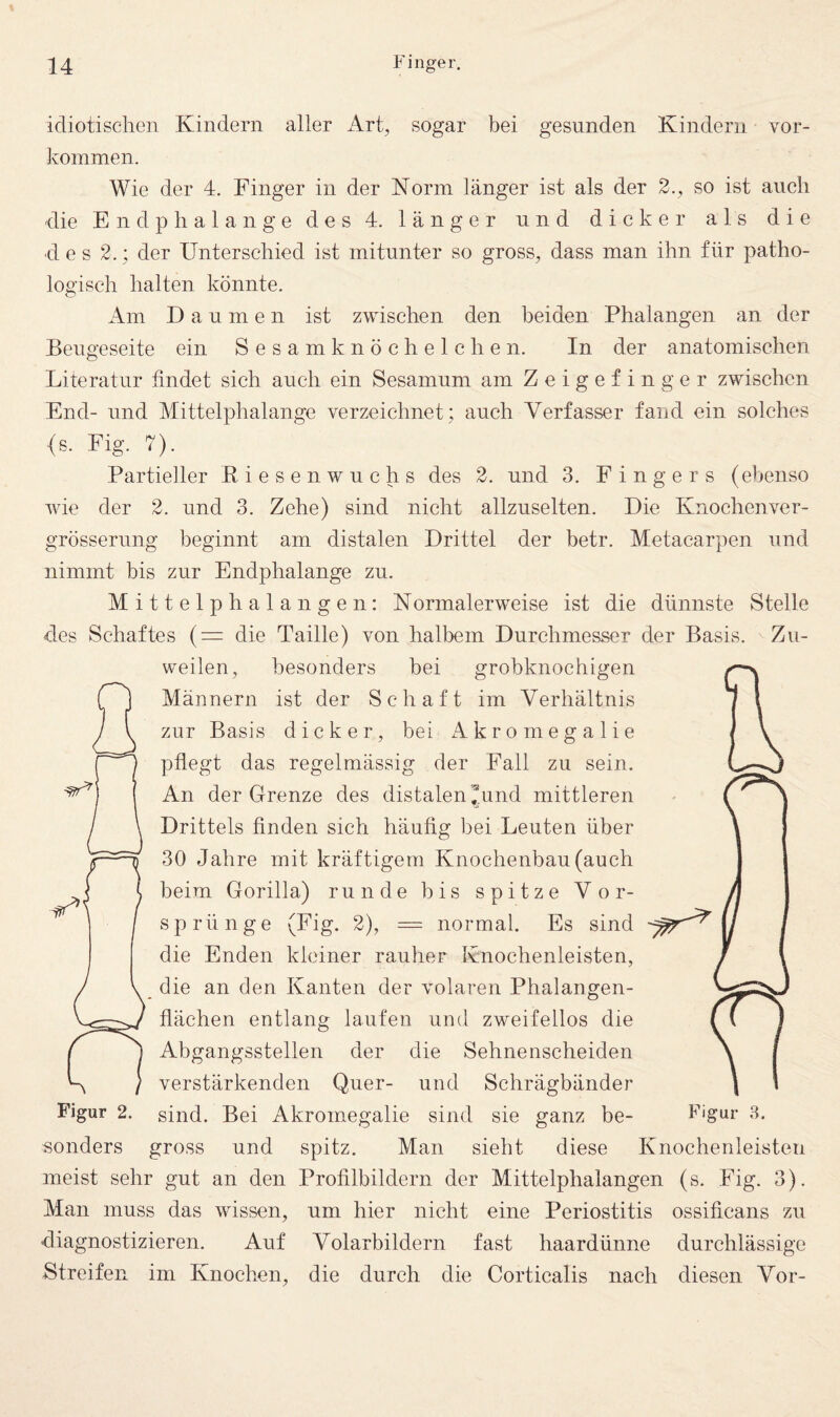 idiotiselien Kindern aller Art, sogar bei gesunden Kindern Vor¬ kommen. Wie der 4. Finger in der Norm länger ist als der 2., so ist auch die Endplialange des 4. länger und dicker als die •d e s 2.; der Unterschied ist mitunter so gross, dass man ihn für patho¬ logisch halten könnte. Am Daumen ist zwischen den beiden Phalangen an der Beugeseite ein Sesamknöchelchen. In der anatomischen Literatur findet sich auch ein Sesamum am Zeigefinger zwischen End- und Mittelphalange verzeichnet; auch Verfasser fand ein solches (s. Fig. 7). Partieller E. iesenwuchs des 2. und 3. Fingers (ebenso wie der 2. und 3. Zehe) sind nicht allzuselten. Die Knochenver- grösserung beginnt am distalen Drittel der betr. Metacarpen und nimmt bis zur Endplialange zu. Mittelphalangen: Normalerweise ist die dünnste Stelle des Schaftes (= die Taille) von halbem Durchmesser der Basis. Zu- vreilen, besonders bei grobknochigen Männern ist der Schaft im Verhältnis zur Basis dicker, bei Akromegalie pflegt das regelmässig der Fall zu sein. An der Grenze des distalen ®und mittleren Drittels finden sich häufig bei Leuten über 30 Jahre mit kräftigem Knochenbau (auch beim Gorilla) runde bis spitze Vor¬ sprünge (Fig. 2), = normal. Es sind die Enden kleiner rauher Knochenleisten, die an den Kanten der volaren Phalangen¬ flächen entlang laufen und zweifellos die Abgangsstellen der die Sehnenscheiden verstärkenden Quer- und Schrägbänder sind. Bei Akromegalie sind sie ganz be- gross und spitz. Man sieht diese Knochenleisten meist sehr gut an den Profilbildern der Mittelphalangen (s. Fig. 3). Man muss das wissen, um hier nicht eine Periostitis ossificans zu diagnostizieren. Auf Volarbildern fast haardünne durchlässige Streifen im Knochen, die durch die Corticalis nach diesen Vor- Figur 2 sonders Figur 3,