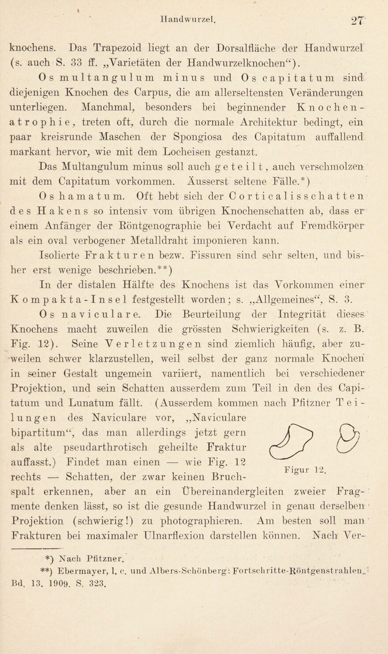 t Handwurzel. 2T knochens. Das Trapezoid liegt an der Dorsalliäche der Handwurzel (s. anch S. 33 ff. „Varietäten der Handwnrzelknoclien^‘). Os mnltangnlnin minus und Os capitatnm sind diejenigen Knochen des Carpns^ die am allerseltensten Veränderungen unterliegen. Manchmal, besonders bei beginnender Knochen- atrophie, treten oft, durch die normale Architektur bedingt, ein paar kreisrunde Maschen der Spongiosa des Capitatnm auffallend markant hervor, wie mit dem Locheisen gestanzt. Das Mnltangnlum minus soll anch geteilt, anch verschmolzen mit dem Capitatnm Vorkommen. Änsserst seltene Fälle.*) Os h a m a t n m. Oft hebt sich der Co rticalissc hatten des Hakens so intensiv vom übrigen Knochenschatten ab, dass er einem Anfänger der Eöntgenographie bei Verdacht auf Fremdkörper als ein oval verbogener Metalldraht imponieren kann. Isolierte Fr a k t n r e n bezw. Fissuren sind sehr selten, und bis¬ her erst wenige beschrieben.**) In der distalen Hälfte des Knochens ist das Vorkommen einer Kompakta-Insel festgestellt worden; s. „Allgemeines^^, S. 3. Os navicnlare. Die Beurteilung der Integrität dieses Knochens macht zuweilen die grössten Schwierigkeiten (s. z. B. Fig. 12). Seine V erletznngen sind ziemlich häufig, aber zu¬ weilen schwer klarznstellen, weil selbst der ganz normale Knochen in seiner Gestalt ungemein variiert, namentlich bei verschiedener Projektion, und sein Schatten ausserdem znm Teil in den des Capi- tatum und Lunatum fällt. (Ausserdem kommen nach Pfitzner Tei¬ lungen des Navicnlare vor, „Navicnlare bipartitnm‘b das man allerdings jetzt gern als alte psendarthrotisch geheilte Fraktur auffasst.) Findet man einen — wie Fig. 12 rechts — Schatten, der zwar keinen Brnch- spalt erkennen, aber an ein Übereinandergleiten zweier Frag¬ mente denken lässt, so ist die gesunde Handwurzel in genau derselben > Projektion (schwierig!) zu photographieren. Am besten soll man Frakturen bei maximaler Ulnarfiexion darstellen können. Nach Ver- *) Nach Pfitzner. **) Ebermayer, 1. c. und Albers-Sclionberg: Fortschritte-Röntgenstiahlen..-