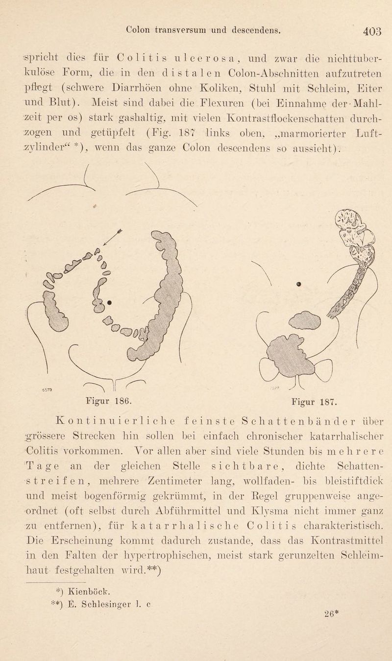 ■spricht dies für Colitis ulcerosa^ und zwar die nichttuber¬ kulöse Foriip die in den distalen Colon-Abschnitten anfzntreten ptl-egt (schwere Diarrhöen ohne Koliken, Stuhl mit Schleim, Eiter und Blut). Meist sind dabei die Flexnren (bei Einnahme der-Mahl¬ zeit per os) stark gashaltig, mit vielen Kontrasttlockenschatten dnrch- -zogen und getüpfelt (Fig. 187 links ol^en, „marmorierter Luft- ,z}dinder‘'*), wenn das ganze Colon descendens so anssieht). Figur 186. K 0 111 i 11 n i e r 1 i c h e feinste S c h a 11 e n b ä n d e r über ■grössere Strecken hin sollen bei einfach chronischer katarrhalischer Colitis Vorkommen. Vor allen aber sind viele Stunden bis mehrere Tage an der gleichen Stelle sichtbare, dichte Schatten- streifen, mehrere Zentimeter lang, wollfaden- bis bleistiftdick lind meist bogenförmig gekrümmt, in der Kegel gruppenweise ange¬ ordnet (oft selbst durch Abführmittel und Klysma nicht immer ganz zu entfernen), für katarrhalische Colitis charakteristisch. Die Erscheinung kommt dadurch zustande, dass das Kontrastmittel in den Falten der hypertrophischen, meist stark gerunzelten Schleim¬ haut festgehalten wird.^*) D Kienböck. E. Schlesinger 1. c