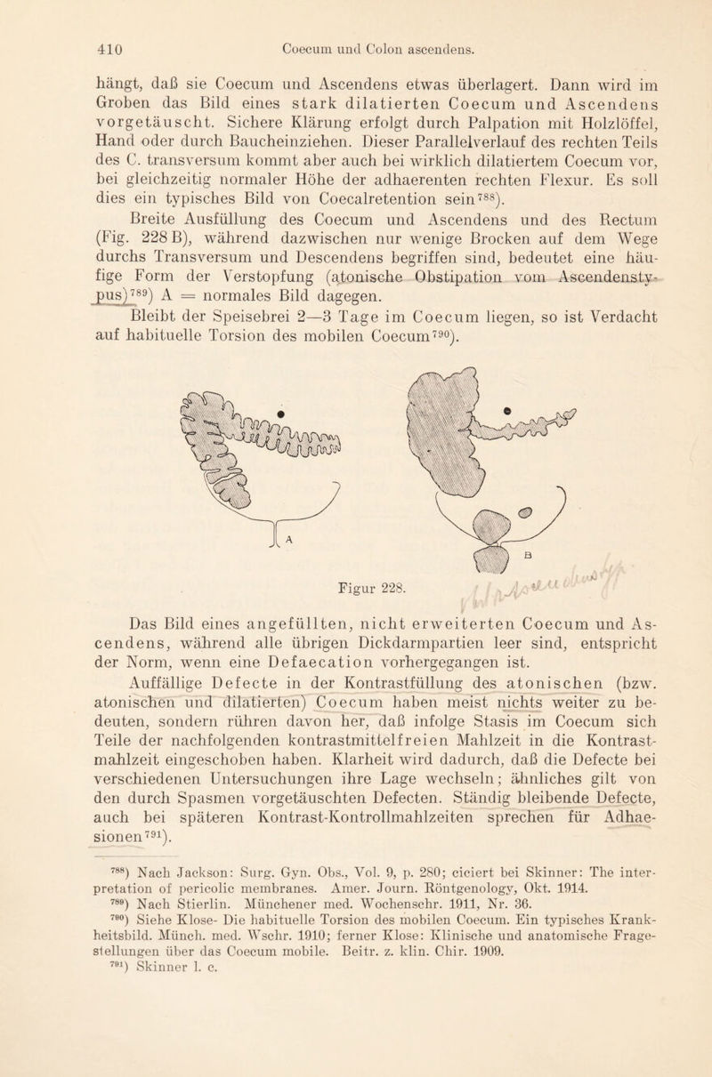 hängt, daß sie Coecum und Ascendens etwas überlagert. Dann wird im Groben das Bild eines stark dilatierten Coecum und Ascendens vorgetäuscht. Sichere Klärung erfolgt durch Palpation mit Holzlöffel, Hand oder durch Baucheinziehen. Dieser Parallelverlauf des rechten Teils des C. transversum kommt aber auch bei wirklich dilatiertem Coecum vor, bei gleichzeitig normaler Höhe der adhaerenten rechten Flexur. Es soll dies ein typisches Bild von Coecalretention sein788). Breite Ausfüllung des Coecum und Ascendens und des Rectum (Fig. 228 B), während dazwischen nur wenige Brocken auf dem Wege durchs Transversum und Descendens begriffen sind, bedeutet eine häu¬ fige Form der Verstopfung (atonische Obstipation vom Ascendensty- ) A = normales Bild dagegen. Bleibt der Speisebrei 2—3 Tage im Coecum liegen, so ist Verdacht auf habituelle Torsion des mobilen Coecum790). Figur 228. Das Bild eines angefüllten, nicht erweiterten Coecum und As¬ cendens, während alle übrigen Dickdarmpartien leer sind, entspricht der Norm, wenn eine Defaecation vorhergegangen ist. Auffällige Defecte in der Kontrastfüllung des atonischen (bzw. atonischen und dilatierten) Coecum haben meist nichts weiter zu be¬ deuten, sondern rühren davon her, daß infolge Stasis im Coecum sich Teile der nachfolgenden kontrastmittelfreien Mahlzeit in die Kontrast¬ mahlzeit eingeschoben haben. Klarheit wird dadurch, daß die Defecte bei verschiedenen Untersuchungen ihre Lage wechseln; ähnliches gilt von den durch Spasmen vorgetäuschten Defecten. Ständig bleibende Defecte, auch bei späteren Kontrast-Kontrollmahlzeiten sprechen für Adhae- sionen791). 788) Nach Jackson: Surg. Gyn. Obs., Vol. 9, p. 280; ciciert bei Skinner: The Inter¬ pretation of pericolic membranes. Amer. Journ. Röntgenology, Okt. 1914. 789) Nach Stierlin. Münchener med. Wochenschr. 1911, Nr. 36. 79°) Siehe Klose- Die habituelle Torsion des mobilen Coecum. Ein typisches Krank¬ heitsbild. Münch, med. Wschr. 1910; ferner Klose: Klinische und anatomische Frage¬ siellungen über das Coecum mobile. Beitr. z. klin. Chir. 1909. 791) Skinner 1. c.
