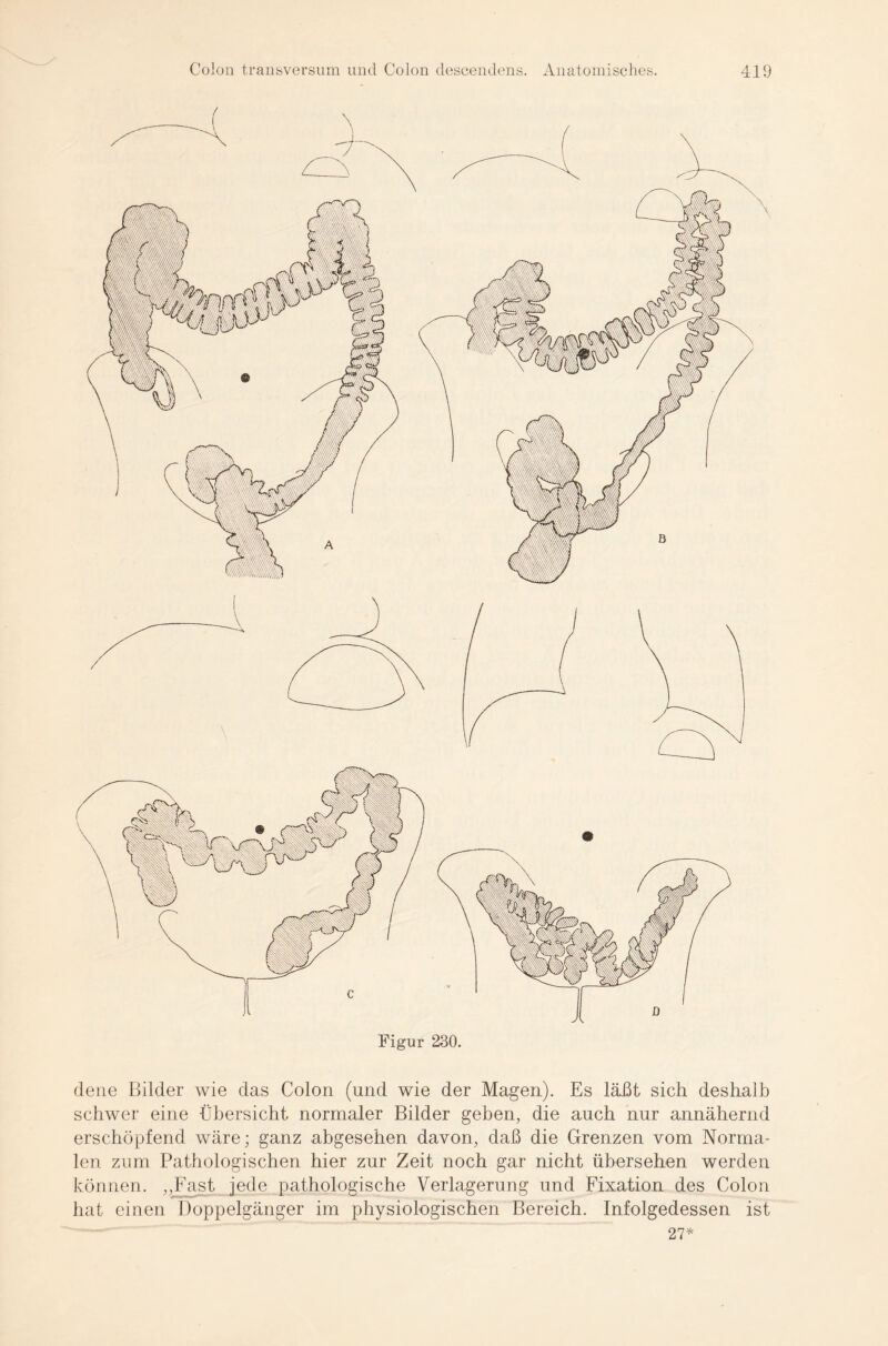 Figur 230. dene Bilder wie das Colon (und wie der Magen). Es läßt sich deshalb schwer eine Übersicht normaler Bilder geben, die auch nur annähernd erschöpfend wäre; ganz abgesehen davon, daß die Grenzen vom Norma¬ len zum Pathologischen hier zur Zeit noch gar nicht übersehen werden können. „Fast jede pathologische Verlagerung und Fixation des Colon hat einen Doppelgänger im physiologischen Bereich. Infolgedessen ist 27*