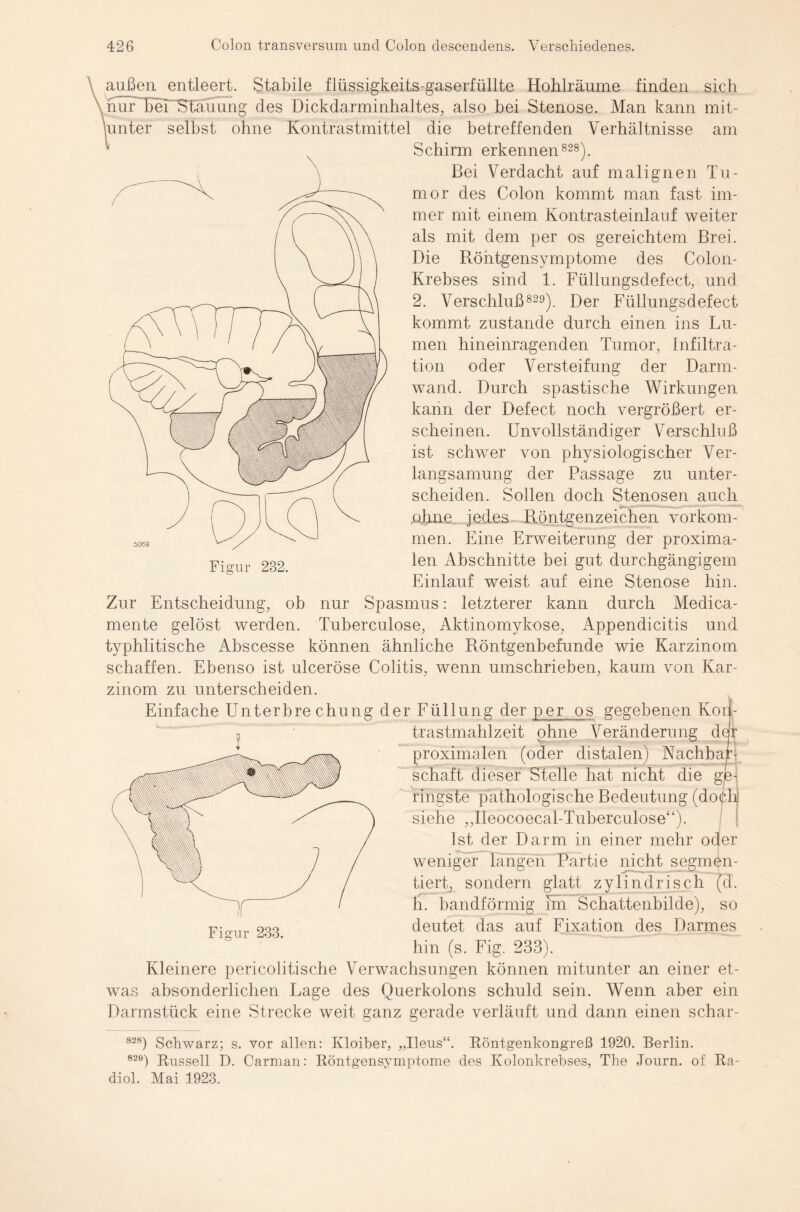 außen entleert. Stabile flüssigkeits-gaserfüllte Hohlräume finden sich nur Hei Stauung des Dickdarminhaltes, also bei Stenose. Man kann mit¬ unter selbst ohne Kontrastmittel die betreffenden Verhältnisse am Schirm erkennen828). Bei Verdacht auf malignen Tu¬ mor des Colon kommt man fast im¬ mer mit einem Kontrasteinlauf weiter als mit dem per os gereichtem Brei. Die Röntgensymptome des Colon- Krebses sind 1. Füllungsdefect, und 2. Verschluß829). Der Füllungsdefect kommt zustande durch einen ins Lu¬ men hineinragenden Tumor, Infiltra¬ tion oder Versteifung der Darm¬ wand. Durch spastische Wirkungen kann der Defect noch vergrößert er¬ scheinen. Unvollständiger Verschluß ist schwer von physiologischer Ver¬ langsamung der Passage zu unter¬ scheiden. Sollen doch Stenosen auch ohne jedes Röntgenzeichen Vorkom¬ men. Eine Erweiterung der proxima¬ len Abschnitte bei gut durchgängigem Einlauf weist auf eine Stenose hin. Zur Entscheidung, ob nur Spasmus: letzterer kann durch Medica- mente gelöst werden. Tuberculose, Aktinomykose, Appendicitis und typhlitische Abscesse können ähnliche Röntgenbefunde wie Karzinom schaffen. Ebenso ist ulceröse Colitis, wenn umschrieben, kaum von Kar¬ zinom zu unterscheiden. Einfache Unterbrechung der Füllung der per os gegebenen Koil- trastmahlzeit ohne Veränderung der proximalen (oder distalen) Nachbar¬ schaft dieser Stelle hat nicht die ge¬ ringste pathologische Bedeutung (do^K siehe ,,Ileocoecal-Tuberculose“). Ist der Darm in einer mehr oder weniger langen Partie nicht segmen¬ tiert, sondern glatt zylindrisch (d. h. bandförmig im Schattenbilde), so deutet das auf Fixation des Darmes hin (s. Fig. 233). Kleinere pericolitische Verwachsungen können mitunter an einer et¬ was absonderlichen Lage des Querkolons schuld sein. Wenn aber ein Darmstück eine Strecke weit ganz gerade verläuft und dann einen schar- 828) Schwarz; s. vor allen: Kloiber, „Ileus“. Röntgenkongreß 1920. Berlin. 820) Russell D. Carman: Röntgensymptome des Kolonkrebses, The Journ. of Ra- diol. Mai 1923.