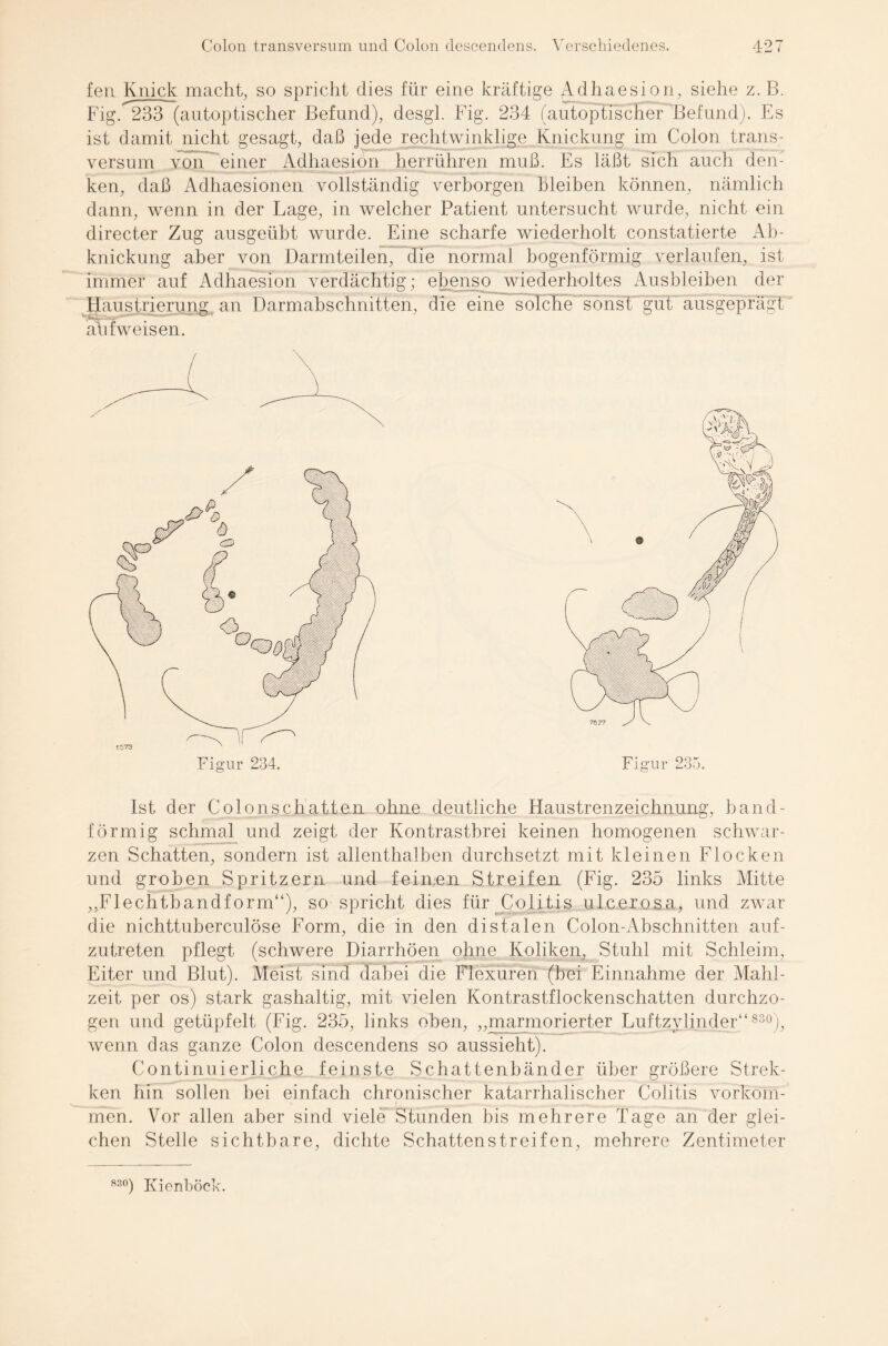 fen Knick macht, so spricht dies für eine kräftige Adhaesion, siehe z. B. Fig. 233 (autoptischer Befund), desgl. Fig. 234 (autoptischer Befund). Es ist damit nicht gesagt, daß jede rechtwinklige Knickung im Colon trans¬ versum von einer Adhaesion herrühren muß. Es läßt sich auch den¬ ken, daß Adhaesionen vollständig verborgen bleiben können, nämlich dann, wenn in der Lage, in welcher Patient untersucht wurde, nicht ein directer Zug ausgeübt wurde. Eine scharfe wiederholt constatierte Ab¬ knickung aber von Darmteilen, die normal bogenförmig verlaufen, ist immer auf Adhaesion verdächtig; ebenso wiederholtes Ausbleiben der Haustrierung an Darmabschnitten, die eine solche sonst gut ausgeprägt '-vt. “■ aufweisen. Ist der Colonschatten ohne deutliche Haustrenzeichnung, band¬ förmig schmal und zeigt der Kontrastbrei keinen homogenen schwar¬ zen Schatten, sondern ist allenthalben durchsetzt mit kleinen Flocken und groben Spritzern und feimein Streifen (Fig. 235 links Mitte ,,Flechtbandform“), so spricht dies für Colitis ulcerosa, und zwar die nichttuberculöse Form, die in den distalen Colon-Abschnitten auf¬ zutreten pflegt (schwere Diarrhöen ohne Koliken, Stuhl mit Schleim, Eiter und Blut). Meist sind dabei die Flexuren (hei Einnahme der Mahl¬ zeit per os) stark gashaltig, mit vielen Kontrastflockenschatten durchzo¬ gen und getüpfelt (Fig. 235, links oben, „marmorierter Luftzylinder“ 830), wenn das ganze Colon descendens so aussieht). Continu ierlichg feinste Schattenbänder über größere Strek- ken hin sollen hei einfach chronischer katarrhalischer Colitis Vorkom¬ men. Vor allen aber sind viele Stunden bis mehrere Tage an der glei¬ chen Stelle sichtbare, dichte Schattenstreifen, mehrere Zentimeter 830) Kienböck.