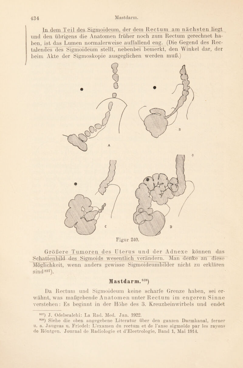 In dem Teil des Sigmoideum, der dem Rectum am nächsten liegt und den übrigens die Anatomen früher noch zum Rectum gerechnet ha¬ ben, ist das Lumen normalerweise auffallend eng. (Die Gegend des Rec¬ talendes des Sigmoideum stellt, nebenbei bemerkt, den Winkel dar, der beim Akte der Sigmoskopie ausgeglichen werden muß.) Figur 240. Größere Tumoren des Uterus und der Adnexe können das Schattenbild des Sigmoids wesentlich verändern. Man denke an diese Möglichkeit, wenn anders gewisse Sigmoideumbilder nicht zu erklären sind 837). Mastdarm. 838) Da Rectum und Sigmoideum keine scharfe Grenze haben, sei er¬ wähnt, was maßgebende Anatomen unter Rectum im engeren Sinne verstehen: Es beginnt in der Höhe des 3. Kreuzbeinwirbels und endet 837) J. Oclelscalchi: La Rad. Med. Jan. 1922. 838) Siehe die oben angegebene Literatur über den ganzen Darmkanal, ferner u. a. Jaugeas u. Friedei: L’examen du rectum et de l'anse sigmoide par les ravons de Röntgen. Journal de Radiologie et d’Electrologie, Band 1, Mai 1914.