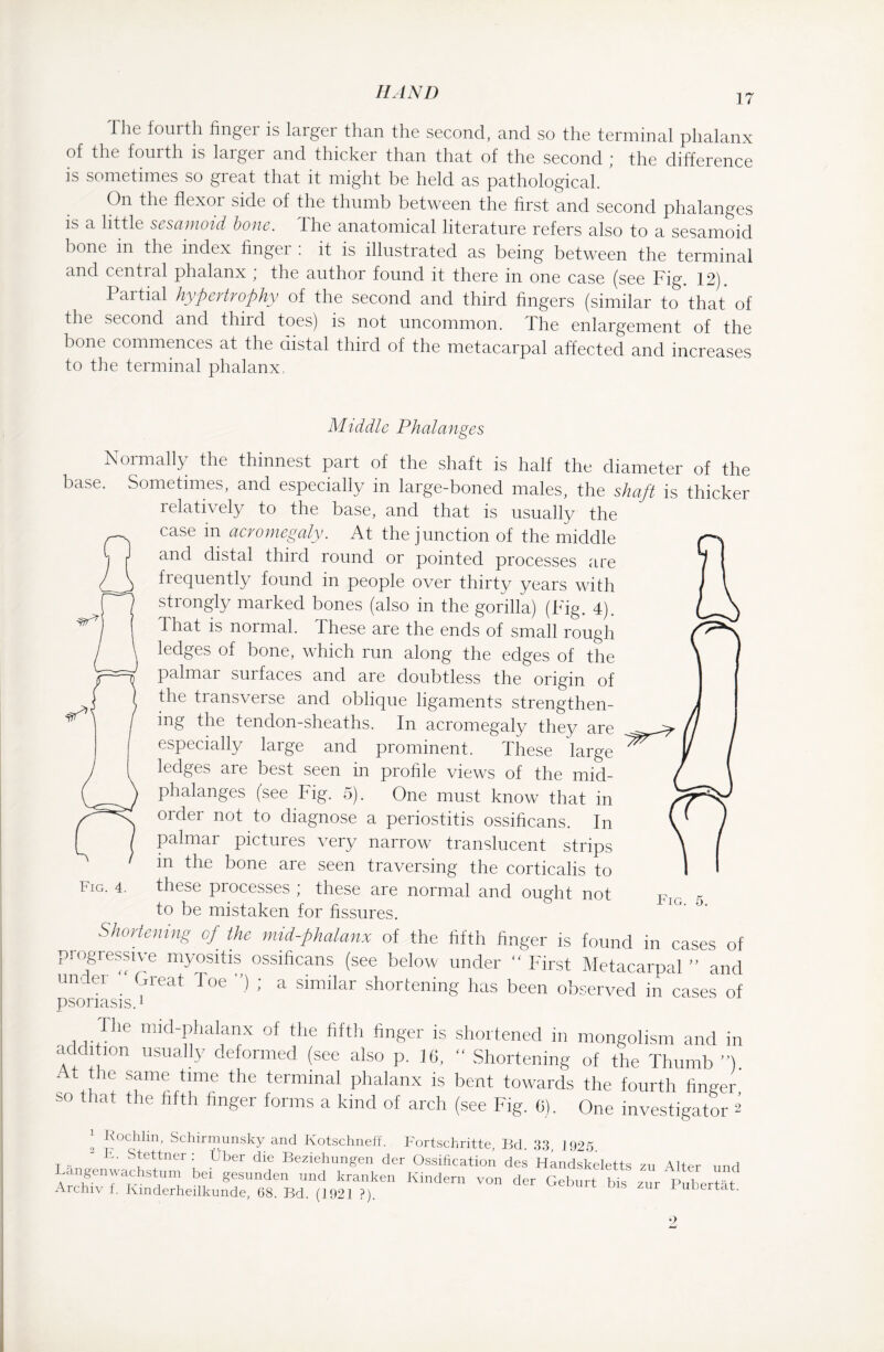 17 I he fourth hngei is larger than the second, and so the terminal phalanx of the fourth is larger and thicker than that of the second ; the difference is sometimes so great that it might be held as pathological. ’ On the flexor side of the thumb between the first and second phalanges is a little sesamoid bone. The anatomical literature refers also to a sesamoid bone in the index finger : it is illustrated as being between the terminal and central phalanx ; the author found it there in one case (see Fig. 12). Partial hypertrophy of the second and third fingers (similar to that of the second and third toes) is not uncommon. The enlargement of the bone commences at the distal third of the metacarpal affected and increases to the terminal phalanx. Middle Phalanges Normally the thinnest part of the shaft is half the diameter of the base. Sometimes, and especially in large-boned males, the shaft is thicker relatively to the base, and that is usually the case in acromegaly. At the junction of the middle and distal third round or pointed processes are frequently found in people over thirty years with strongly marked bones (also in the gorilla) (Fig. 4). dhat is normal. JThese are the ends of small rough ledges of bone, which run along the edges of the palmar surfaces and are doubtless the origin of the transverse and oblique ligaments strengthen¬ ing the tendon-sheaths. In acromegaly they are especially large and prominent. These large Fig. 4. Fig. 5. ledges are best seen in profile views of the mid- phalanges (see big. 5). One must know that in order not to diagnose a periostitis ossificans. In palmar pictures very narrow translucent strips in the bone are seen traversing the corticalis to these processes ; these are normal and ought not to be mistaken for fissures. Shortening of the mid-phalanx of the fifth finger is found in cases of progressiv«; myositis ossificans (see below under “ First Metacarpal ” and  el 'jreat 1 oe ’) >' a similar shortening has been observed in cases of psoriasis.1 The mid-phalanx of the fifth finger is shortened in mongolism and in addi ion usually deformed (see also p. 16, “ Shortening of the Thumb ’*) At the same time the terminal phalanx is bent towards the fourth finger so that the fifth finger forms a kind of arch (see Fig. 6). One investigator 2 l Schirmunsky and Kotschneff. Fortschritte, Bd. 33, 1925. T •• ~ Stettner : Über die Beziehungen der Ossification des Handskeletts zu Alter und angenWachstum bei gesunden und kranken Kindern von der Geburt bis zur Pubertät Archiv f. Kinderheilkunde, 68. Bd. (1921 ?). I ubertat.