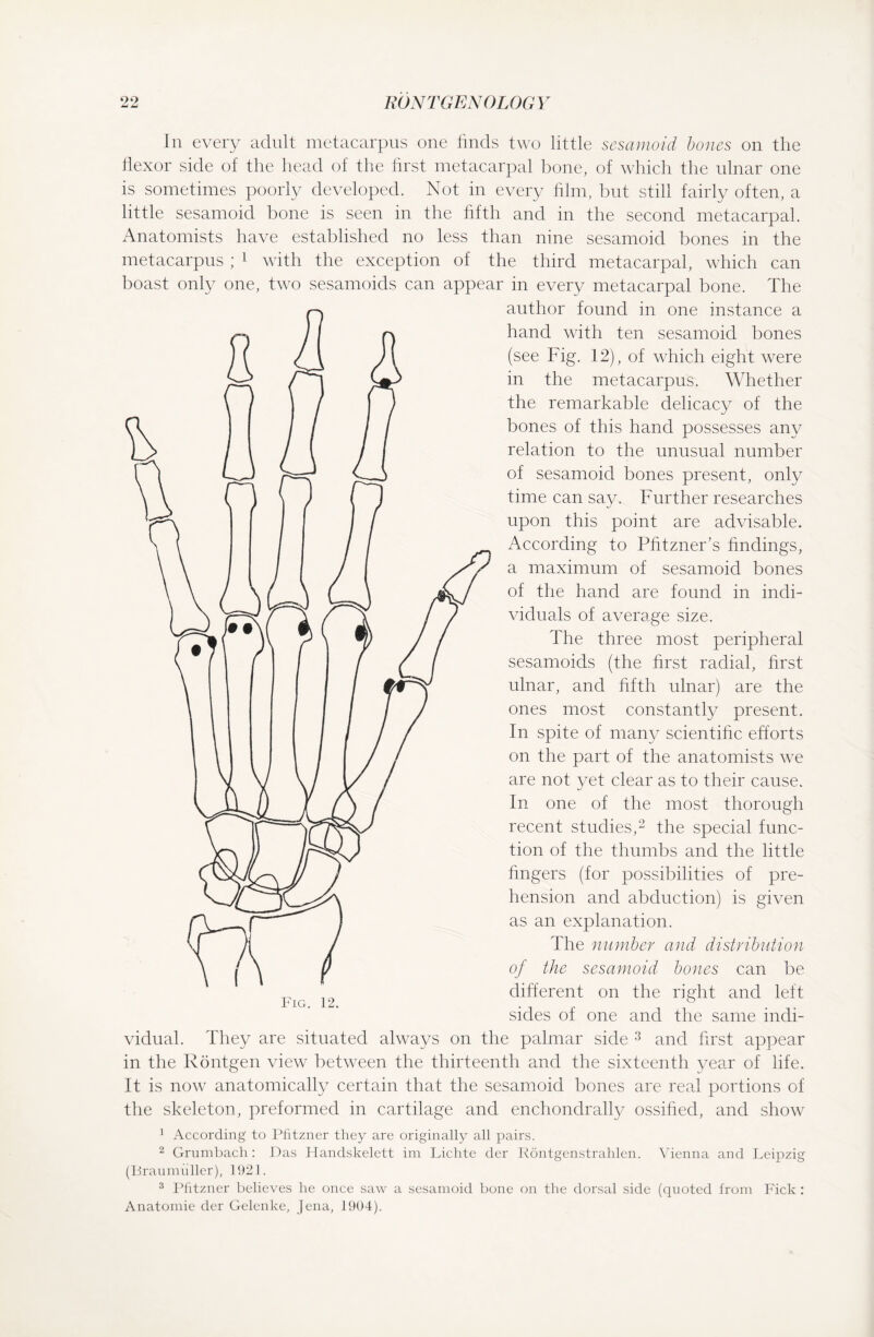 oo — ~ RÖNTGEN OLOG Y In every adult metacarpus one finds two little sesamoid bones on the ilexor side of the head of the first metacarpal bone, of which the ulnar one is sometimes poorly developed. Not in every film, but still fairly often, a little sesamoid bone is seen in the fifth and in the second metacarpal. Anatomists have established no less than nine sesamoid bones in the metacarpus; 1 with the exception of the third metacarpal, which can boast only one, two sesamoids can appear in every metacarpal bone. The author found in one instance a hand with ten sesamoid bones (see Fig. 12), of which eight were in the metacarpus. Whether the remarkable delicacy of the bones of this hand possesses any relation to the unusual number of sesamoid bones present, only time can say. Further researches upon this point are advisable. According to Pfitzner’s findings, a maximum of sesamoid bones of the hand are found in indi¬ viduals of average size. The three most peripheral sesamoids (the first radial, first ulnar, and fifth ulnar) are the ones most constantly present. In spite of many scientific efforts on the part of the anatomists we are not yet clear as to their cause. In one of the most thorough recent studies,2 the special func¬ tion of the thumbs and the little fingers (for possibilities of pre¬ hension and abduction) is given as an explanation. The number and distribution of the sesamoid bones can be different on the right and left sides of one and the same indi¬ vidual. They are situated always on the palmar side 3 and first appear in the Röntgen view between the thirteenth and the sixteenth year of life. It is now anatomically certain that the sesamoid bones are real portions of the skeleton, preformed in cartilage and enchondrally ossified, and show 1 According to Pfitzner they are originally all pairs. 2 Grumbach: Das Handskelett im Lichte der Röntgenstrahlen. Vienna and Leipzig (Braumuller), 1921. 3 Pfitzner believes he once saw a sesamoid bone on the dorsal side (quoted from Fick : Anatomie der Gelenke, Jena, 1904).