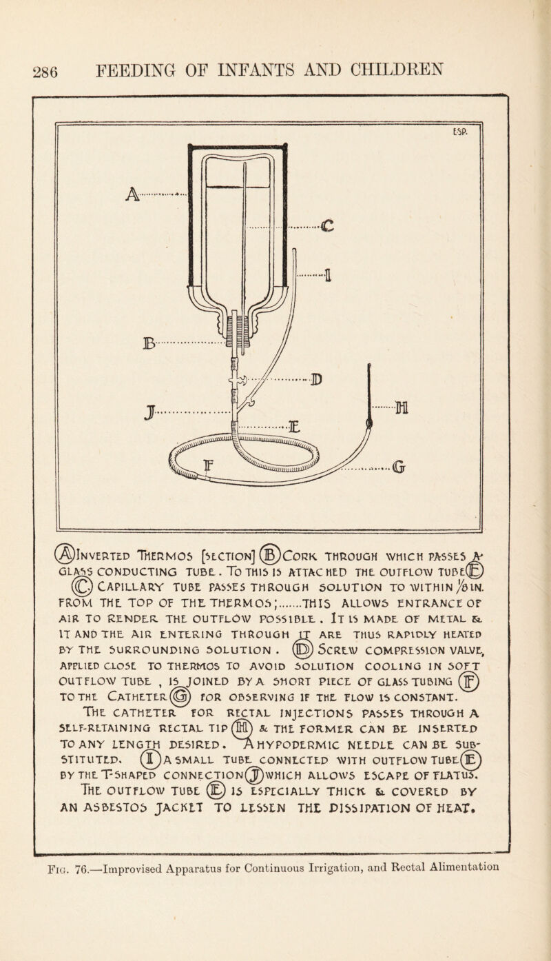 ©Inverted Thermos [section] (B)Cork through which passes a* GLASS CONDUCTING TUBE. To THIS IS ATTACHED THE OUTFLOW TUBE© ((Q) Capillary tube passes through solution to within/bin. FROM THE TOP OF THE. THERMOS;.THIS ALLOWS ENTRANCE Of AIR TO RENDER THE OUTFLOW POSSIBLE . It IS MADE OF METAL 5L IT AND THE AIR ENTERING THROUGH IT ARE THUS RAPIDLY HEATLP BY THE SURROUNDING SOLUTION . (6) SCREW COMPRESSION VALVE, APPLIED CLOSE TO THERMOS TO AVOID SOLUTION COOLING IN SOFT OUTFLOW TUBE , IS JOINED BY A SHORT PIECE OF GLASS TUBING (jp) TO THE CaTHETEr(@) FOR OBSERVING IF THE FLOW IS CONSTANT. The CATHETER FOR RECTAL INJECTIONS PASSES THROUGH A SELF-RETAINING RECTAL TIP (®) Sc THE FORMER CAN BE INSERTED TO ANY LENGTH DESIRED. HYPODERMIC NEEDLE CAN BE SUB¬ STITUTED. (©A SMALL TUBE CONNECTED WITH OUTFLOW TUBe(£) by the T-shaped connection(jT)which allows escape of tlatus; The outflow tube (E) is especially thick &. covered by AN ASBESTOS JACKET TO LESSEN THE DISSIPATION OF HEAT. Fig. 76.—Improvised Apparatus for Continuous Irrigation, and Rectal Alimentation