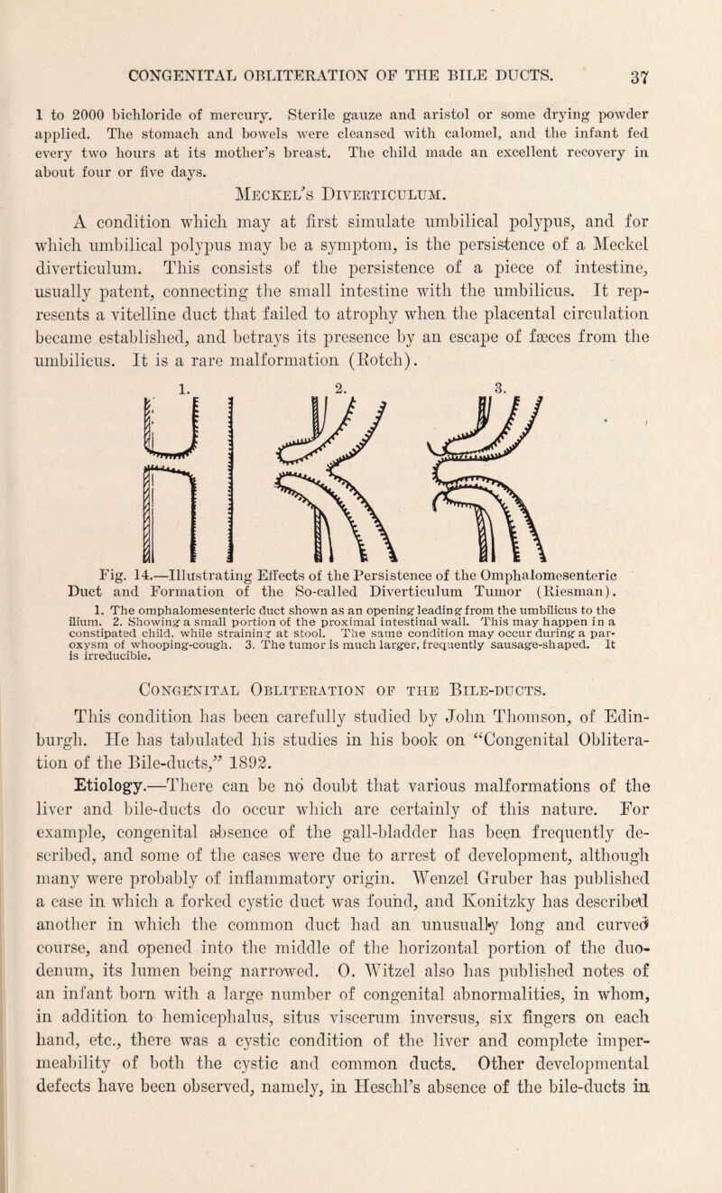 1 to 2000 bichloride of mercury. Sterile gauze and aristol or some drying powder applied. The stomach and bowels were cleansed with calomel, and the infant fed every two hours at its mother’s breast. The child made an excellent recovery in about four or five days. Meckel's Diverticulum. A condition which may at first simulate umbilical polypus, and for which umbilical polypus may be a symptom, is the persistence of a Meckel diverticulum. This consists of the persistence of a piece of intestine, usually patent, connecting the small intestine with the umbilicus. It rep¬ resents a vitelline duct that failed to atrophy when the placental circulation became established, and betrays its presence by an escape of fasces from the umbilicus. It is a rare malformation (Rotch). 1. 2. 3. Fig. 14.—Illustrating Effects of the Persistence of the Omphalomesenteric Duct and Formation of the So-called Diverticulum Tumor (Riesman). 1. The omphalomesenteric duct shown as an opening-leading-from the umbilicus to the ilium. 2. Showing a small portion of the proximal intestinal wall. This may happen in a constipated child, while straining at stool. The same condition may occur during a par¬ oxysm of whooping-cough. 3. The tumor is much larger, frequently sausage-shaped. It is irreducible. Congenital Obliteration of tile Bile-ducts. This condition has been carefully studied by John Thomson, of Edin¬ burgh. He has tabulated his studies in his book on “Congenital Oblitera¬ tion of the Bile-ducts,” 1892. Etiology.—There can be no doubt that various malformations of the liver and bile-ducts do occur which are certainlv of this nature. For J example, congenital absence of the gall-bladder has been frequently de¬ scribed, and some of the cases were due to arrest of development, although many were probably of inflammatory origin. Wenzel Gruber has published a case in which a forked cystic duct was found, and Konitzky lias described another in which the common duct had an unusually long and curved course, and opened into the middle of the horizontal portion of the duo¬ denum, its lumen being narrowed. 0. Witzel also has published notes of an infant bom with a large number of congenital abnormalities, in whom, in addition to hemicephalus, situs viscerum inversus, six fingers on each hand, etc., there was a cystic condition of the liver and complete imper¬ meability of both the cystic and common ducts. Other developmental defects have been observed, namely, in Heschl’s absence of the bile-ducts in
