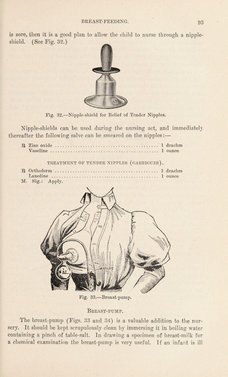 is sore, then it is a good plan to allow the child to nurse through a nipple- shield. (See Fig. 32.) Fig. 32.—Nipple-sliield for Relief of Tender Nipples. Nipple-shields can be used during the nursing act, and immediately thereafter the following salve can be smeared on the nipples :— R Zinc oxide .. 1 drachm Vaseline..... 1 ounce TREATMENT OF TENDER NIPPLES (OARRIGUES). R Orthoform ... 1 drachm Lanoline ..... 1 ounce M. Sig.: Apply. Fig. 33.—Breast-pump. Breast-pump. The breast-pump (Figs. 33 and 34) is a valuable addition to the nur¬ sery. It should he kept scrupulously clean by immersing it in boiling water containing a pinch of table-salt. In drawing a specimen of breast-milk for a chemical examination the breast-pump is very useful. If an infant is ill