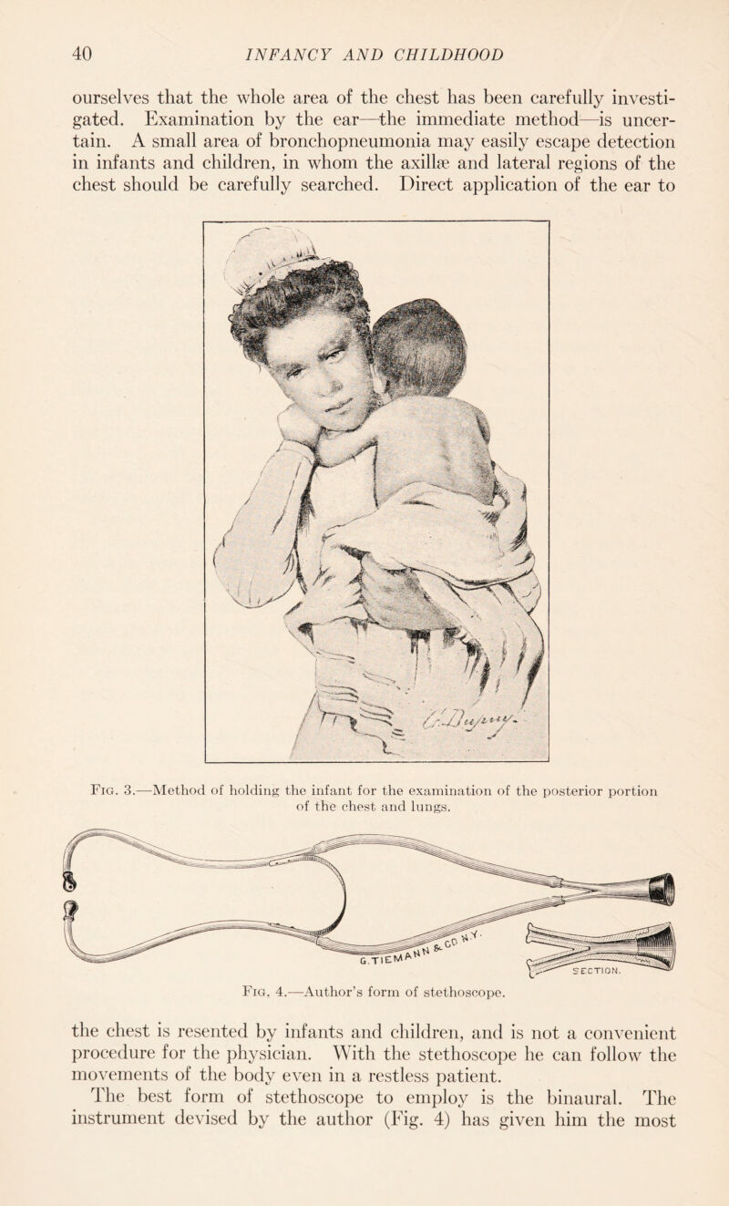 ourselves that the whole area of the chest has been carefully investi¬ gated. Examination by the ear—the immediate method—is uncer¬ tain. A small area of bronchopneumonia may easily escape detection in infants and children, in whom the axillae and lateral regions of the chest should be carefully searched. Direct application of the ear to Fig. 3.—Method of holding the infant for the examination of the posterior portion of the chest and lungs. the chest is resented by infants and children, and is not a convenient procedure for the physician. With the stethoscope he can follow the movements of the body even in a restless patient. The best form of stethoscope to employ is the binaural. The instrument devised by the author (Fig. 4) has given him the most