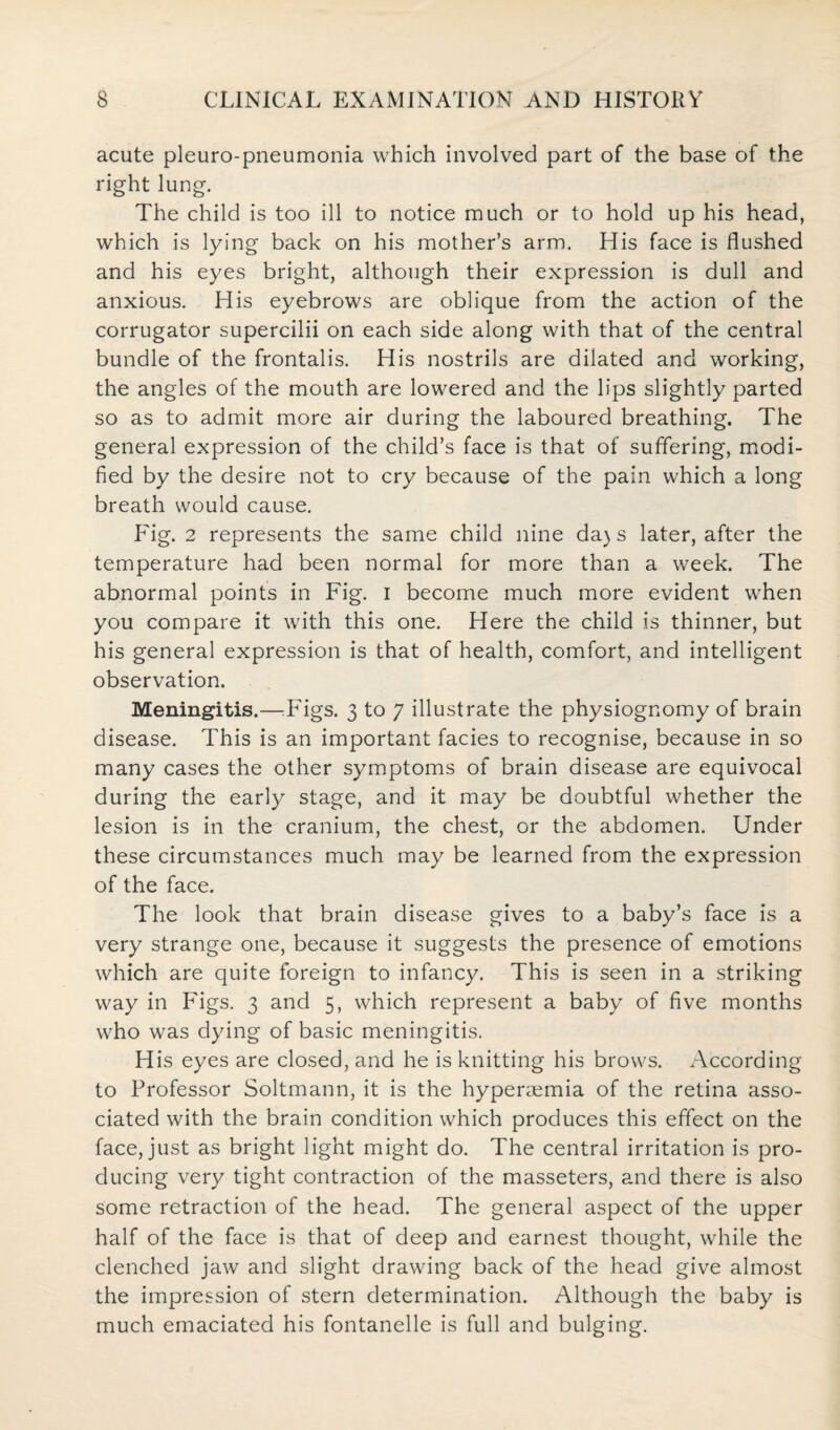acute pleuropneumonia which involved part of the base of the right lung. The child is too ill to notice much or to hold up his head, which is lying back on his mother’s arm. His face is flushed and his eyes bright, although their expression is dull and anxious. His eyebrows are oblique from the action of the corrugator supercilii on each side along with that of the central bundle of the frontalis. His nostrils are dilated and working, the angles of the mouth are lowered and the lips slightly parted so as to admit more air during the laboured breathing. The general expression of the child’s face is that of suffering, modi¬ fied by the desire not to cry because of the pain which a long breath would cause. P'ig. 2 represents the same child nine da) s later, after the temperature had been normal for more than a week. The abnormal points in Fig. i become much more evident when you compare it with this one. Here the child is thinner, but his general expression is that of health, comfort, and intelligent observation. Meningitis.—Tigs. 3 to 7 illustrate the physiognomy of brain disease. This is an important facies to recognise, because in so many cases the other symptoms of brain disease are equivocal during the early stage, and it may be doubtful whether the lesion is in the cranium, the chest, or the abdomen. Under these circumstances much may be learned from the expression of the face. The look that brain disease gives to a baby’s face is a very strange one, because it suggests the presence of emotions which are quite foreign to infancy. This is seen in a striking way in Figs. 3 and 5, which represent a baby of five months who was dying of basic meningitis. His eyes are closed, and he is knitting his brows. According to Professor Soltmann, it is the hypereemia of the retina asso¬ ciated with the brain condition which produces this effect on the face, just as bright light might do. The central irritation is pro¬ ducing very tight contraction of the masseters, and there is also some retraction of the head. The general aspect of the upper half of the face is that of deep and earnest thought, while the clenched jaw and slight drawing back of the head give almost the impression of stern determination. Although the baby is much emaciated his fontanelle is full and bulging.