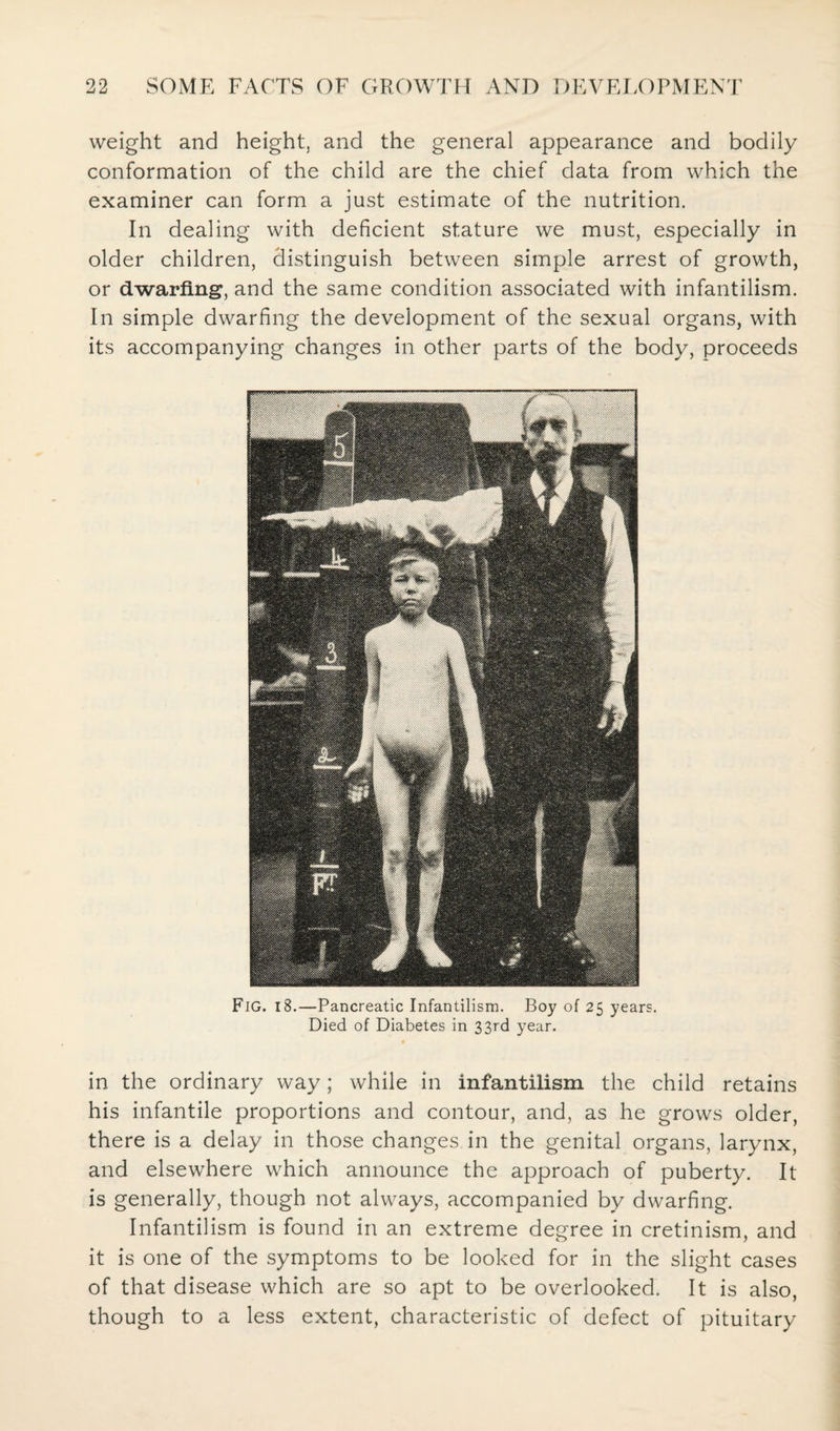 weight and height, and the general appearance and bodily conformation of the child are the chief data from which the examiner can form a just estimate of the nutrition. In dealing with deficient stature we must, especially in older children, distinguish between simple arrest of growth, or dwarfing, and the same condition associated with infantilism. In simple dwarfing the development of the sexual organs, with its accompanying changes in other parts of the body, proceeds Fig. 18.—Pancreatic Infantilism. Boy of 25 years. Died of Diabetes in 33rd year. in the ordinary way; while in infantilism the child retains his infantile proportions and contour, and, as he grows older, there is a delay in those changes in the genital organs, larynx, and elsewhere which announce the approach of puberty. It is generally, though not always, accompanied by dwarfing. Infantilism is found in an extreme degree in cretinism, and it is one of the symptoms to be looked for in the slight cases of that disease which are so apt to be overlooked. It is also, though to a less extent, characteristic of defect of pituitary