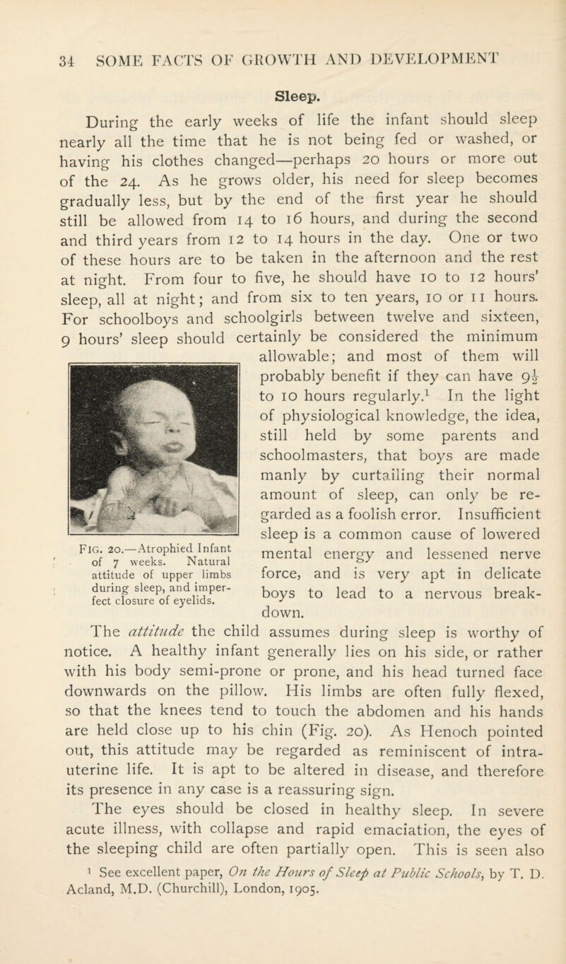 Sleep. During the early weeks of life the infant should sleep nearly all the time that he is not being fed or washed, or having his clothes changed—perhaps 20 hours or more out of the 24. As he grows older, his need for sleep becomes gradually less, but by the end of the first year he should still be allowed from 14 to 16 hours, and during the second and third years from 12 to 14 hours in the day. One or two of these hours are to be taken in the afternoon and the rest at night. From four to five, he should have 10 to 12 hours’ sleep, all at night; and from six to ten years, 10 or 11 hours. For schoolboys and schoolgirls between twelve and sixteen, 9 hours’ sleep should certainly be considered the minimum allowable; and most of them will probably benefit if they can have 9J to 10 hours regularly.1 In the light of physiological knowledge, the idea, still held by some parents and schoolmasters, that boys are made manly by curtailing their normal amount of sleep, can only be re¬ garded as a foolish error. Insufficient sleep is a common cause of lowered mental energy and lessened nerve force, and is very apt in delicate boys to lead to a nervous break¬ down. The attiUide the child assumes during sleep is worthy of notice. A healthy infant generally lies on his side, or rather with his body semi-prone or prone, and his head turned face downwards on the pillow. His limbs are often fully flexed, so that the knees tend to touch the abdomen and his hands are held close up to his chin (Fig. 20). As Henoch pointed out, this attitude may be regarded as reminiscent of intra¬ uterine life. It is apt to be altered in disease, and therefore its presence in any case is a reassuring sign. The eyes should be closed in healthy sleep. In severe acute illness, with collapse and rapid emaciation, the eyes of the sleeping child are often partially open. This is seen also 1 See excellent paper, On the Hours of Sleep at Public Schools, by T. U. Acland, M.D. (Churchill), London, 1905. FlG. 20.—Atrophied Infant of 7 weeks. Natural attitude of upper limbs during sleep, and imper¬ fect closure of eyelids.