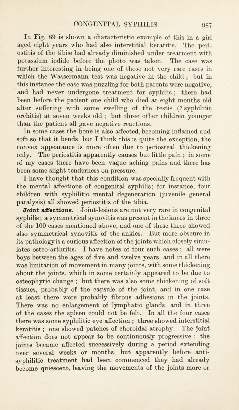 In Eig. 89 is shown a characteristic example of this in a girl aged eight years who had also interstitial keratitis. The peri¬ ostitis of the tibiae had already diminished under treatment with potassium iodide before the photo was taken. The case was further interesting in being one of those not very rare cases in which the Wassermann test was negative in the child ; but in this instance the case was puzzling for both parents were negative, and had never undergone treatment for syphilis ; there had been before the patient one child who died at eight months old after suffering with some swelling of the testis (? syphilitic orchitis) at seven weeks old ; but three other children younger than the patient all gave negative reactions. In some cases the bone is also affected, becoming inflamed and soft so that it bends, but I think this is quite the exception, the convex appearance is more often due to periosteal thickening only. The periostitis apparently causes but little pain ; in some of my cases there have been vague aching pains and there has been some slight tenderness on pressure. I have thought that this condition was specially frequent with the mental affections of congenital syphilis; for instance, four children with syphilitic mental degeneration (juvenile general paralysis) all showed periostitis of the tibia. Joint affections. Joint-lesions are not very rare in congenital syphilis; a symmetrical synovitis was present in the knees in three of the 100 cases mentioned above, and one of these three showed also symmetrical synovitis of the ankles. But more obscure in its pathology is a curious affection of the joints which closely simu¬ lates osteo-arthritis. I have notes of four such cases ; all were boys between the ages of five and twelve years, and in all there was limitation of movement in many joints, with some thickening about the joints, which in some certainly appeared to be due to osteophytic change ; but there was also some thickening of soft tissues, probably of the capsule of the joint, and in one case at least there were probably fibrous adhesions in the joints. There was no enlargement of lymphatic glands, and in three of the cases the spleen could not be felt. In all the four cases there was some syphilitic eye affection ; three showed interstitial keratitis ; one showed patches of choroidal atrophy. The joint affection does not appear to be continuously progressive : the joints became affected successively during a period extending over several weeks or months, but apparently before anti¬ syphilitic treatment had been commenced they had already become quiescent, leaving the movements of the joints more or