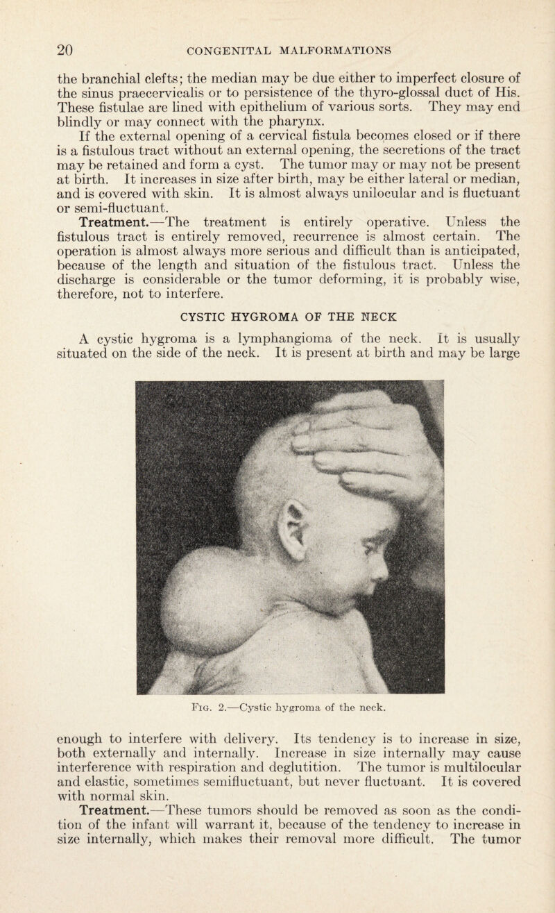 the branchial clefts; the median may be due either to imperfect closure of the sinus praecervicalis or to persistence of the thyro-glossal duct of His. These fistulae are lined with epithelium of various sorts. They may end blindly or may connect with the pharynx. If the external opening of a cervical fistula becomes closed or if there is a fistulous tract without an external opening, the secretions of the tract may be retained and form a cyst. The tumor may or may not be present at birth. It increases in size after birth, may be either lateral or median, and is covered with skin. It is almost always unilocular and is fluctuant or semi-fluctuant. Treatment.—The treatment is entirely operative. Unless the fistulous tract is entirely removed, recurrence is almost certain. The operation is almost always more serious and difficult than is anticipated, because of the length and situation of the fistulous tract. Unless the discharge is considerable or the tumor deforming, it is probably wise, therefore, not to interfere. CYSTIC HYGROMA OF THE NECK A cystic hygroma is a lymphangioma of the neck, it is usually situated on the side of the neck. It is present at birth and may be large Fig. 2.—Cystic hygroma of the neck. enough to interfere with delivery. Its tendency is to increase in size, both externally and internally. Increase in size internally may cause interference with respiration and deglutition. The tumor is multilocular and elastic, sometimes semifluctuant, but never fluctuant. It is covered with normal skin. Treatment.—These tumors should be removed as soon as the condi¬ tion of the infant will warrant it, because of the tendency to increase in size internally, which makes their removal more difficult. The tumor