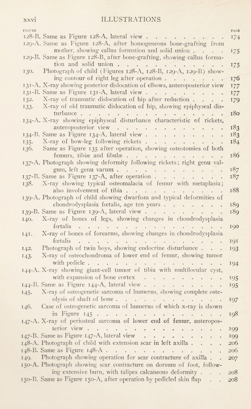 FIGURE 128- B. Same as Figure 128-A, lateral view. 129- A. Same as Figure 128-A, after homogeneous bone-grafting from mother, showing callus formation and solid union .... 129-B. Same as Figure 128-B, after bone-grafting, showing callus forma¬ tion and solid union. 130. Photograph of child (Figures 128-A, 128-B, 129-A, 129-B) show¬ ing contour of right leg after operation. 131-A. X-ray showing posterior dislocation of elbows, anteroposterior view 131-B. Same as Figure 131-A, lateral view. 132. X-ray of traumatic dislocation of hip after reduction . 133. X-ray of old traumatic dislocation of hip, showing epiphyseal dis¬ turbance . 134-A. X-ray showing epiphyseal disturbance characteristic of rickets, anteroposterior view. 134-B. Same as Figure 134-A, lateral view. 135. X-ray of bow-leg following rickets. 136. Same as Figure 135 after operation, showing osteotomies of both femurs, tibiae and fibulae. 137-A. Photograph showing deformity following rickets; right genu val¬ gum, left genu varum. . 137-B. Same as Figure 137-A, after operation. 138. X-ray showing typical osteomalacia of femur with metaplasia; also involvement of tibia. 139-A. Photograph of child showing dwarfism and typical deformities of chondrodysplasia foetalis, age ten years. 139-B. Same as Figure 139-A, lateral view. 140. X-ray of bones of legs, showing changes in chondrodysplasia foetalis. 141. X-ray of bones of forearms, showing changes in chondrodysplasia foetalis. 142. Photograph of twin boys, showing endocrine disturbance . 143. X-ray of osteochondroma of lower end of femur, showing tumor with pedicle. 144-A. X-ray showing giant-cell tumor of tibia with multilocular cyst, with expansion of bone cortex. 144-B. Same as Figure 144-A, lateral view. 145. X-ray of osteogenetic sarcoma of humerus, showing complete oste¬ olysis of shaft of bone. 146. Case of osteogenetic sarcoma of humerus of which x-ray is shown in Figure 145.. 147-A. X-ray of periosteal sarcoma of lower end of femur, anteropos¬ terior view. 147- B. Same as Figure 147-A, lateral view. 148- A. Photograph of child with extension scar in left axilla .... 148-B. Same as Figure 148-A. 149. Photograph showing operation for scar contracture of axilla . 150-A. Photograph showing scar contracture on dorsum of foot, follow¬ ing extensive burn, with talipes calcaneous deformity . 150-B. Same as Figure 150-A, after operation by pedicled skin flap PAGE 1/4 U5 175 176 177 177 179 ISO 183 183 184 J.86 187 187 188 I89 189 190 191 193 194 195 195 197 198 199 199 206 206 207 208 208