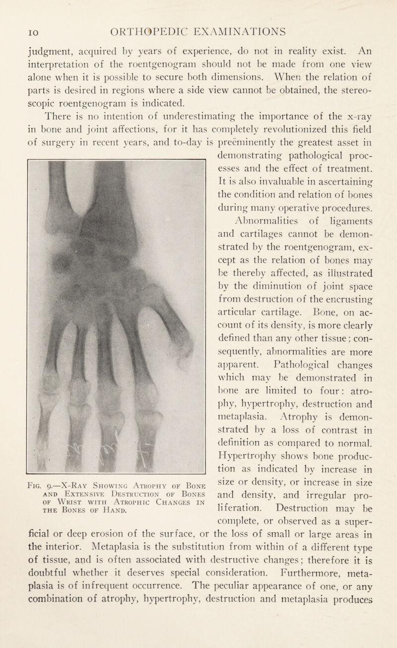 judgment, acquired by years of experience, do not in reality exist. An interpretation of the roentgenogram should not he made from one view alone when it is possible to secure both dimensions. When the relation of parts is desired in regions where a side view cannot be obtained, the stereo¬ scopic roentgenogram is indicated. There is no intention of underestimating the importance of the x-ray in bone and joint affections, for it has completely revolutionized this field of surgery in recent years, and to-day is preeminently the greatest asset in demonstrating pathological proc¬ esses and the effect of treatment. It is also invaluable in ascertaining the condition and relation of bones during many operative procedures. Abnormalities of ligaments and cartilages cannot be demon¬ strated by the roentgenogram, ex¬ cept as the relation of bones may be thereby affected, as illustrated by the diminution of joint space from destruction of the encrusting articular cartilage. Bone, on ac¬ count of its density, is more clearly defined than any other tissue; con¬ sequently, abnormalities are more apparent. Pathological changes which may be demonstrated in bone are limited to four: atro¬ phy, hypertrophy, destruction and metaplasia. Atrophy is demon¬ strated by a loss of contrast in definition as compared to normal. Hypertrophy shows bone produc¬ tion as indicated by increase in size or density, or increase in size and density, and irregular pro¬ liferation. Destruction may be complete, or observed as a super¬ ficial or deep erosion of the surface, or the loss of small or large areas in the interior. Metaplasia is the substitution from within of a different type of tissue, and is often associated with destructive changes; therefore it is doubtful whether it deserves special consideration. Furthermore, meta¬ plasia is of infrequent occurrence. The peculiar appearance of one, or any combination of atrophy, hypertrophy, destruction and metaplasia produces Fig. 9.—X-Ray Showing Atrophy of Bone and Extensive Destruction of Bones of Wrist with Atrophic Changes in the Bones of Hand.
