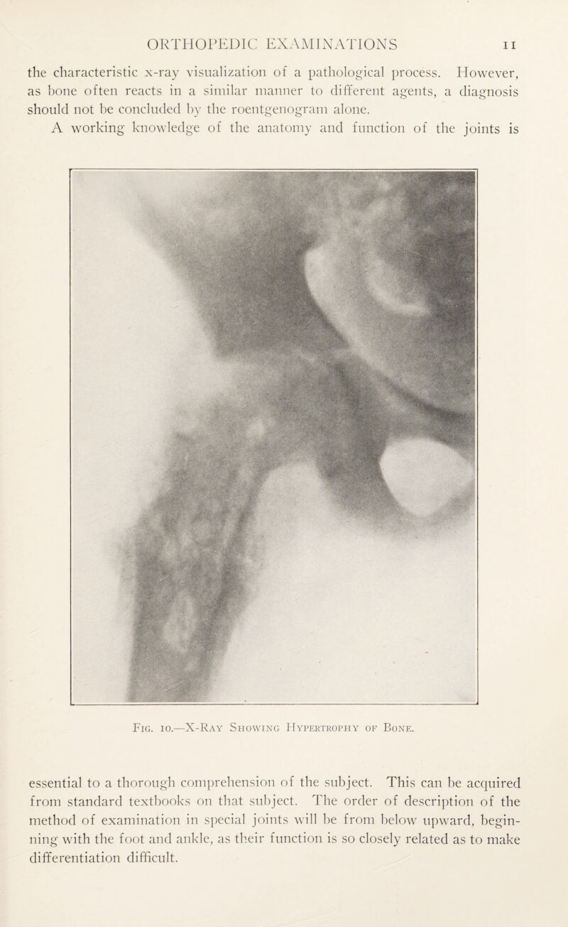 the characteristic x-ray visualization of a pathological process. However, as bone often reacts in a similar manner to different agents, a diagnosis should not he concluded by the roentgenogram alone. A working knowledge of the anatomy and function of the joints is Fig. io.—X-Ray Showing Hypertrophy of Bone. essential to a thorough comprehension of the subject. This can be acquired from standard textbooks on that subject. The order of description of the method of examination in special joints will be from below upward, begin¬ ning with the foot and ankle, as their function is so closely related as to make differentiation difficult.