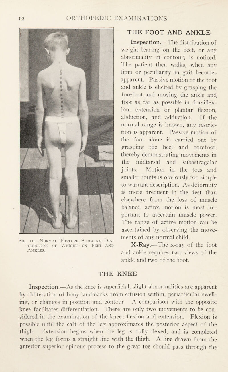 Fig. ii.—Normal Posture Showing Dis¬ tribution of Weight on Feet and Ankles. THE FOOT AND ANKLE Inspection.—The distribution of weight-hearing on the feet, or any abnormality in contour, is noticed. The patient then walks, when any limp or peculiarity in gait becomes apparent. Passive motion of the foot and ankle is elicited by grasping the forefoot and moving the ankle and foot as far as possible in dorsiflex- ion, extension or plantar flexion, abduction, and adduction. If the normal range is known, any restric¬ tion is apparent. Passive motion of the foot alone is carried out by grasping the heel and forefoot, thereby demonstrating movements in the midtarsal and subastragalar joints. Motion in the toes and smaller joints is obviously too simple to warrant description. As deformity is more frequent in the feet than elsewhere from the loss of muscle balance, active motion is most im¬ portant to ascertain muscle power. The range of active motion can be ascertained by observing the move¬ ments of any normal child. X-Ray.—The x-ray of the foot and ankle requires two views of the ankle and two of the foot. THE KNEE Inspection.—As the knee is superficial, slight abnormalities are apparent by obliteration of bony landmarks from effusion within, periarticular swell¬ ing, or changes in position and contour. A comparison with the opposite knee facilitates differentiation. There are only two movements to be con¬ sidered in the examination of the knee: flexion and extension. Flexion is possible until the calf of the leg approximates the posterior aspect of the thigh. Extension begins when the leg is fully flexed, and is completed when the leg forms a straight line with the thigh. A line drawn from the anterior superior spinous process to the great toe should pass through the