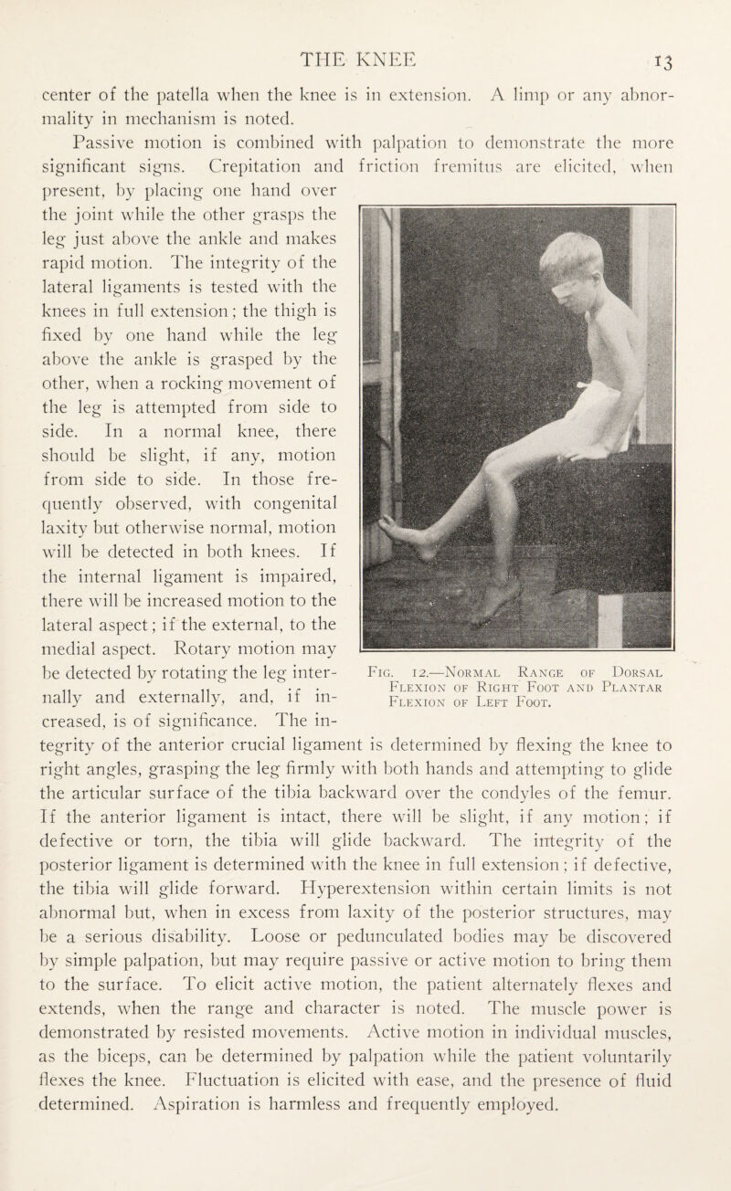 center of the patella when the knee is in extension. A limp or any abnor¬ mality in mechanism is noted. Passive motion is combined with palpation to demonstrate the more significant signs. Crepitation and friction fremitus are elicited, when present, by placing one hand over the joint while the other grasps the leg just above the ankle and makes rapid motion. The integrity of the lateral ligaments is tested with the knees in full extension; the thigh is fixed by one hand while the leg above the ankle is grasped by the other, when a rocking movement of the leg is attempted from side to side. In a normal knee, there should be slight, if any, motion from side to side. In those fre¬ quently observed, with congenital laxity but otherwise normal, motion will be detected in both knees. If the internal ligament is impaired, there will be increased motion to the lateral aspect; if the external, to the medial aspect. Rotary motion may he detected by rotating the leg inter- , and, if in¬ creased, is of significance. The in¬ tegrity of the anterior crucial ligament is determined by flexing the knee to right angles, grasping the leg firmly with both hands and attempting to glide the articular surface of the tibia backward over the condyles of the femur. If the anterior ligament is intact, there will be slight, if any motion; if defective or torn, the tibia will glide backward. The integrity of the posterior ligament is determined with the knee in full extension; if defective, the tibia will glide forward. Hyperextension within certain limits is not abnormal but, when in excess from laxity of the posterior structures, may he a serious disability. Loose or pedunculated bodies may be discovered by simple palpation, but may require passive or active motion to bring them to the surface. To elicit active motion, the patient alternately flexes and extends, when the range and character is noted. The muscle power is demonstrated by resisted movements. Active motion in individual muscles, as the biceps, can be determined by palpation while the patient voluntarily flexes the knee. Fluctuation is elicited with ease, and the presence of fluid determined. Aspiration is harmless and frequently employed. nally and externally Fig. 12.—Normal Range of Dorsal Flexion of Right Foot and Plantar Flexion of Left Foot.