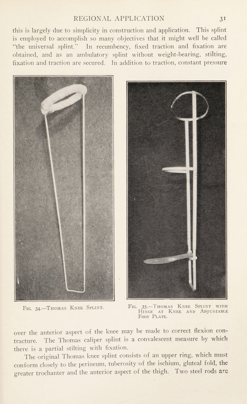 this is largely due to simplicity in construction and application. This splint is employed to accomplish so many objectives that it might well be called “the universal splint.’’ In recumbency, fixed traction and fixation are obtained, and as an ambulatory splint without weight-bearing, stilting, fixation and traction are secured. In addition to traction, constant pressure FIG 34 —Thomas Knee Selint. Fig. 35-—Thomas Knee Splint with Hinge at Knee and Adjustable Foot Plate. over the anterior aspect of the knee may be made to correct flexion con¬ tracture. The Thomas caliper splint is a convalescent measure by which there is a partial stilting with fixation. The original Thomas knee splint consists of an upper ring, which must conform closely to the perineum, tuberosity of the ischium, gluteal fold, the greater trochanter and the anterior aspect of the thigh. Two steel rods arc