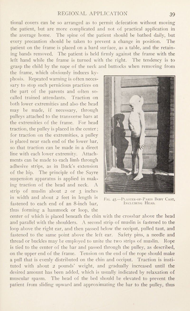 tional covers can be so arranged as to permit defecation without moving the patient, but are more complicated and not of practical application in the average home. The spine of the patient should be bathed daily, but every precaution should be taken to prevent a change in position. The patient on the frame is placed on a hard surface, as a table, and the retain¬ ing bands removed. The patient is held firmly against the frame with the left hand while the frame is turned with the right. The tendency is to grasp the child by the nape of the neck and buttocks when removing from the frame, which obviously induces ky¬ phosis. Repeated warning is often neces¬ sary to stop such pernicious practices on the part of the parents and often so- called trained attendants. Traction on both lower extremities and also the head may be made, if necessary, through pulleys attached to the transverse bars at the extremities of the frame. For head traction, the pulley is placed in the center; for traction on the extremities, a pulley is placed near each end of the lower bar, so that traction can be made in a direct line with each lower extremity. Attach¬ ments can be made to each limb through adhesive strips, as in Buck's extension of the hip. The principle of the Sayre suspension apparatus is applied in mak¬ ing traction of the head and neck. A strip of muslin about 2 or 3 inches in width and about 2 feet in length is fastened to each end of an 8-inch bar, thus forming a hammock or loop, the center of which is placed beneath the chin with the crossbar above the head and parallel with the shoulders. A second strip of muslin is fastened to the loop above the right ear, and then passed below the occiput, pulled taut, and fastened to the same point above the left ear. Safety pins, a needle and thread or buckles may be employed to unite the two strips of muslin. Rope is tied to the center of the bar and passed through the pulley, as described, on the upper end of the frame. Tension on the end of the rope should make a pull that is evenly distributed on the chin and occiput. Traction is insti¬ tuted with about 2 pounds' weight, and gradually increased until the desired amount has been added, which is usually indicated by relaxation of muscular spasm. The head of the bed should be elevated to prevent the patient from sliding upward and approximating the bar to the pulley, thus Fig. 45.—Plaster-of-Paris Body Cast, Including Head.