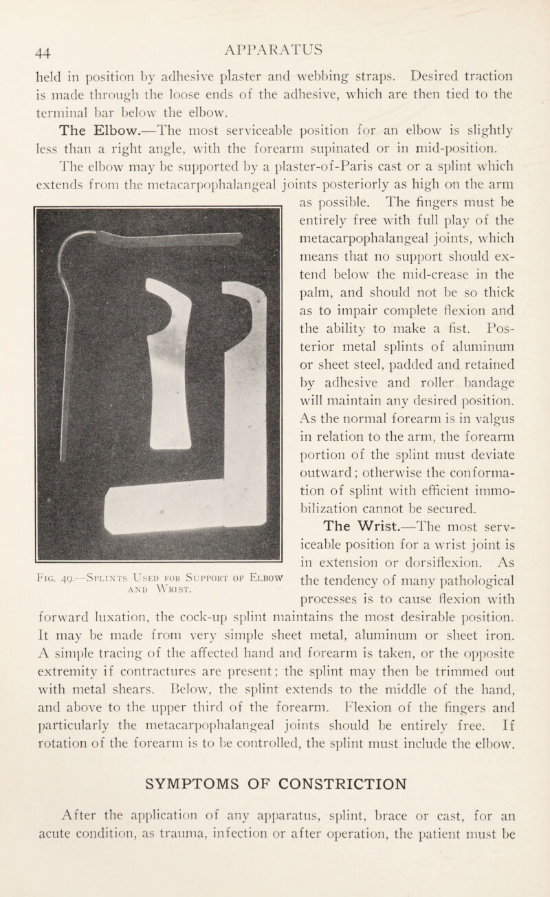 held in position by adhesive plaster and webbing straps. Desired traction is made through the loose ends of the adhesive, which are then tied to the terminal bar below the elbow. The Elbow.—The most serviceable position for an elbow is slightly less than a right angle, with the forearm supinated or in mid-position. The elbow may be supported by a piaster-of-Paris cast or a splint which extends from the metacarpophalangeal joints posteriorly as high on the arm as possible. The fingers must be entirely free with full play of the metacarpophalangeal joints, which means that no support should ex¬ tend below the mid-crease in the palm, and should not be so thick as to impair complete flexion and the ability to make a fist. Pos¬ terior metal splints of aluminum or sheet steel, padded and retained by adhesive and roller bandage will maintain any desired position. As the normal forearm is in valgus in relation to the arm, the forearm portion of the splint must deviate outward; otherwise the conforma¬ tion of splint with efficient immo¬ bilization cannot be secured. The Wrist.—The most serv¬ iceable position for a wrist joint is in extension or dorsiflexion. As the tendency of many pathological processes is to cause flexion with forward luxation, the cock-up splint maintains the most desirable position. It may be made from very simple sheet metal, aluminum or sheet iron. A simple tracing of the affected hand and forearm is taken, or the opposite extremity if contractures are present ; the splint may then be trimmed out with metal shears. Below, the splint extends to the middle of the hand, and above to the upper third of the forearm. Flexion of the fingers and particularly the metacarpophalangeal joints should he entirely free. If rotation of the forearm is to be controlled, the splint must include the elbow. Fig. 49.—Splints Used for Support of Elbow and Wrist. SYMPTOMS OF CONSTRICTION After the application of any apparatus, splint, brace or cast, for an acute condition, as trauma, infection or after operation, the patient must be