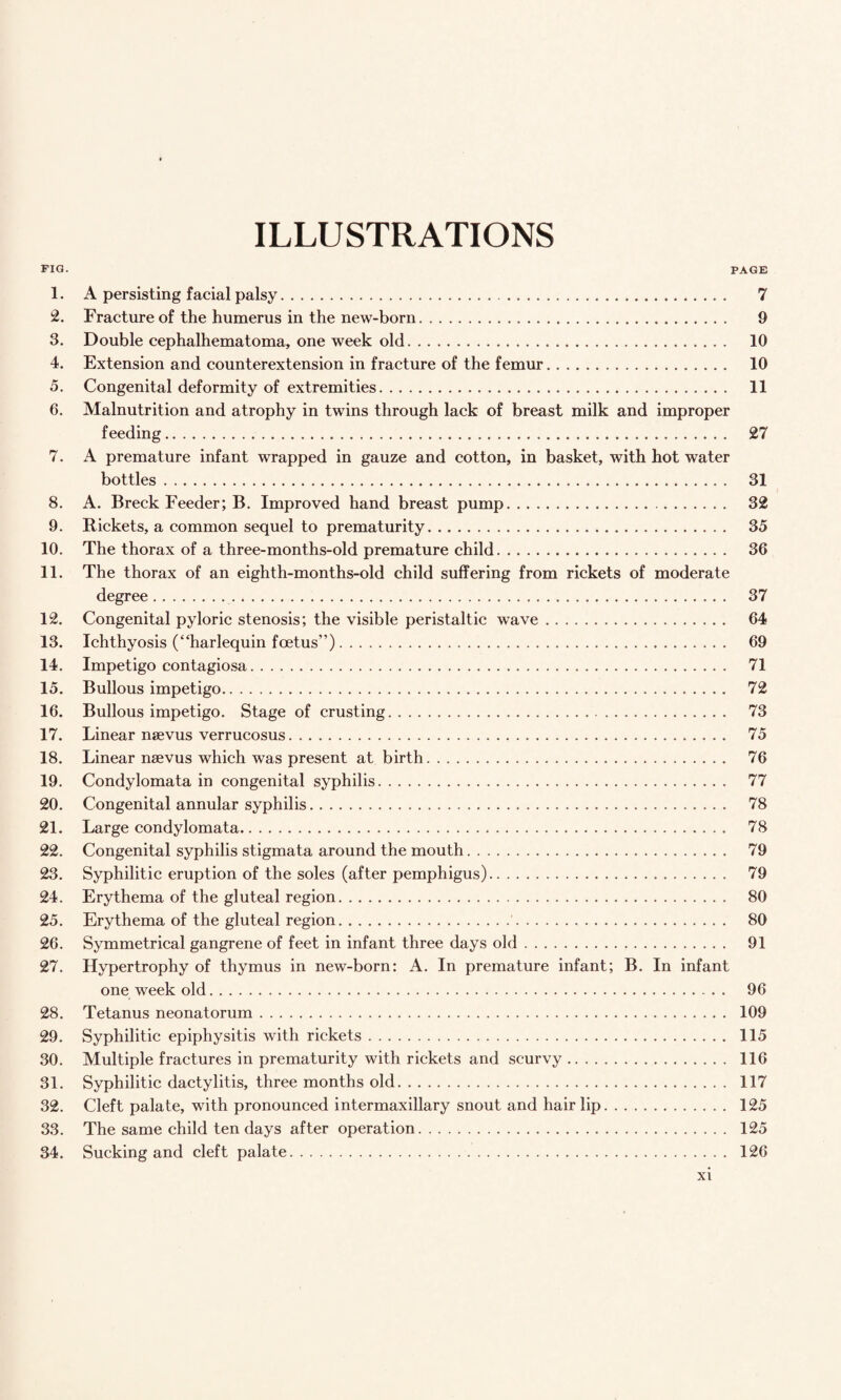 ILLUSTRATIONS FIG. PAGE 1. A persisting facial palsy. 7 2. Fracture of the humerus in the new-born. 9 3. Double cephalhematoma, one week old. 10 4. Extension and counterextension in fracture of the femur. 10 5. Congenital deformity of extremities. 11 6. Malnutrition and atrophy in twins through lack of breast milk and improper feeding. 27 7. A premature infant wrapped in gauze and cotton, in basket, with hot water bottles. 31 8. A. Breck Feeder; B. Improved hand breast pump. 32 9. Rickets, a common sequel to prematurity. 35 10. The thorax of a three-months-old premature child. 36 11. The thorax of an eighth-months-old child suffering from rickets of moderate degree. 37 12. Congenital pyloric stenosis; the visible peristaltic wave. 64 13. Ichthyosis (“harlequin foetus”). 69 14. Impetigo contagio.sa. 71 15. Bullous impetigo. 72 16. Bullous impetigo. Stage of crusting. 73 17. Linear naevus verrucosus. 75 18. Linear naevus which was present at birth. 76 19. Condylomata in congenital syphilis. 77 20. Congenital annular syphilis. 78 21. Large condylomata. 78 22. Congenital syphilis stigmata around the mouth. 79 23. Syphilitic eruption of the soles (after pemphigus). 79 24. Erythema of the gluteal region. 80 25. Erythema of the gluteal region.'. 80 26. Symmetrical gangrene of feet in infant three days old. 91 27. Hypertrophy of thymus in new-born: A. In premature infant; B. In infant one week old. 96 28. Tetanus neonatorum. 109 29. Syphilitic epiphysitis with rickets. 115 30. Multiple fractures in prematurity with rickets and scurvy. 116 31. Syphilitic dactylitis, three months old. 117 32. Cleft palate, with pronounced intermaxillary snout and hair lip. 125 33. The same child ten days after operation. 125 34. Sucking and cleft palate. 126