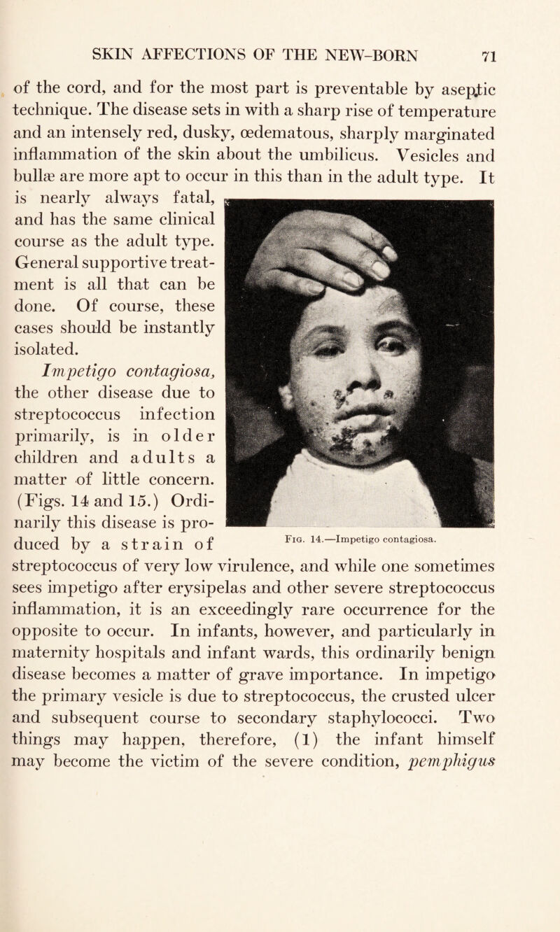 , of the cord, and for the most part is preventable by asepfic technique. The disease sets in with a sharp rise of temperature and an intensely red, dusky, oedematous, sharply marginated inflammation of the skin about the umbilicus. Vesicles and bull« are more apt to occur in this than in the adult type. It is nearly always fatal, and has the same clinical course as the adult type. General supportive treat¬ ment is all that can be done. Of course, these cases should be instantly isolated. Impetigo contagiosa, the other disease due to streptococcus infection primarily, is in older children and adults a matter of little concern. (Figs. 14 and 15.) Ordi- narity this disease is pro¬ duced by a strain of streptococcus of very low virulence, and while one sometimes sees impetigo after erysipelas and other severe streptococcus inflammation, it is an exceedingly rare occurrence for the opposite to occur. In infants, however, and particularly in maternity hospitals and infant wards, this ordinarily benign disease becomes a matter of grave importance. In impetigo the primary vesicle is due to streptococcus, the crusted ulcer and subsequent course to secondary staphylococci. Two things may happen, therefore, (1) the infant himself may become the victim of the severe condition, pemphigus Fig. 14.—Impetigo contagiosa.