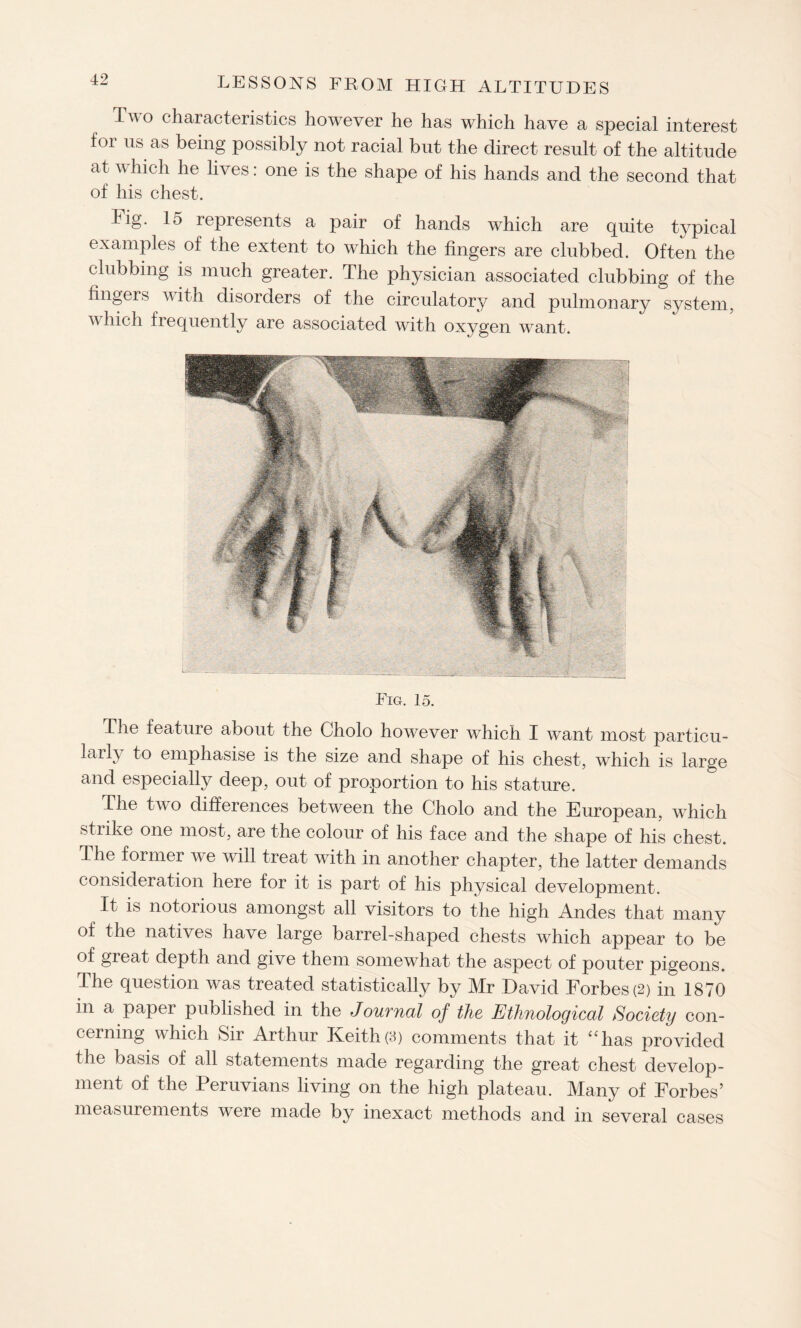 T*° characteristics however he has which have a special interest foi us as being possibly not racial but the direct result of the altitude at which he lives: one is the shape of his hands and the second that of his chest. big. lo represents a pair of hands which are quite typical examples of the extent to which the fingers are clubbed. Often the clubbing is much greater. The physician associated clubbing of the fingers with disorders of the circulatory and pulmonary system, v Inch frequently are associated with oxygen want. Eig. 15. The feature about the Cholo however which I want most particu¬ larly to emphasise is the size and shape of his chest, which is large and especially deep, out of proportion to his stature. The two differences between the Cholo and the European, which strike one most, are the colour of his face and the shape of his chest. The former we will treat with in another chapter, the latter demands consideration here for it is part of his physical development. It is notorious amongst all visitors to the high Andes that many of the natives have large barrel-shaped chests which appear to be of great depth and give them somewhat the aspect of pouter pigeons. The question was treated statistically by Mr David Forbes (2) in 1870 in a paper published in the Jouvnal of the Ethnological Society con¬ cerning which Sir Arthur Keith(3) comments that it “has provided the basis of all statements made regarding the great chest develop¬ ment of the Peruvians living on the high plateau. Many of Forbes’ measurements were made by inexact methods and in several cases