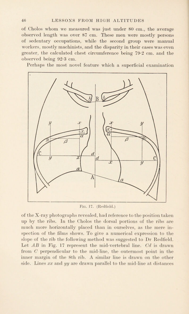 of Cholos whom we measured was just under 80 cm., the average observed length was over 87 cm. These men were mostly persons of sedentary occupations, while the second group were manual workers, mostly machinists, and the disparity in their cases was even greater, the calculated chest circumference being 79-2 cm. and the observed being 92-3 cm. Perhaps the most novel feature which a superficial examination Fig. 17. (Redfield.) of the X-ray photographs revealed, had reference to the position taken up by the ribs. In the Cholos the dorsal portions of the ribs are much more horizontally placed than in ourselves, as the mere in¬ spection of the films shows. To give a numerical expression to the slope of the rib the following method was suggested to Dr Redfield. Let AB in Fig. 17 represent the mid-vertebral line. Cd is drawn from C perpendicular to the mid-line, the outermost point in the inner margin of the 8th rib. A similar line is drawn on the other side. Lines xx and tjy are drawn parallel to the mid-line at distances