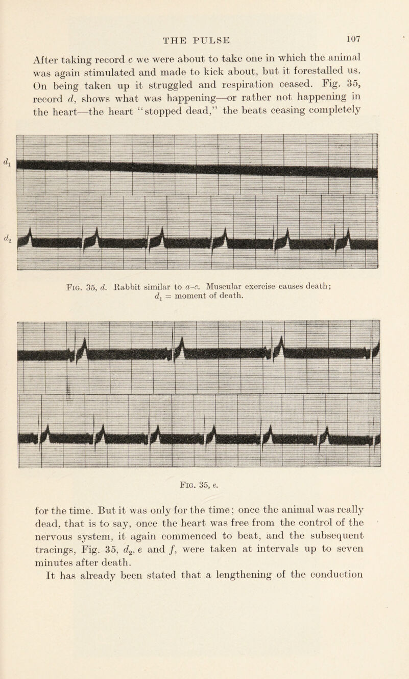 After taking record c we were about to take one in which the animal was again stimulated and made to kick about, but it forestalled us. On being taken up it struggled and respiration ceased. Fig. 35, record d, shows what was happening—or rather not happening in the heart—the heart ^ stopped dead,” the beats ceasing completely Fig. 35, d. Rabbit similar to a-c. Muscular exercise causes death; dl — moment of death. Fig. 35, e. for the time. But it was only for the time; once the animal was really dead, that is to say, once the heart was free from the control of the nervous system, it again commenced to beat, and the subsequent tracings, Fig. 35, d2, e and /, were taken at intervals up to seven minutes after death. It has already been stated that a lengthening of the conduction