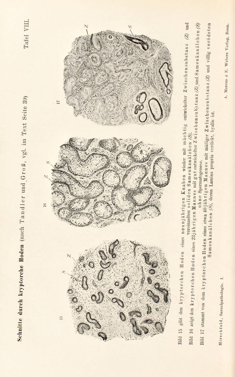 Schnitte durch kryptorche Hoden (nacli T