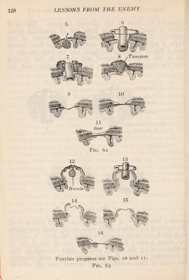 Fig. 62 Further progress see Figs. 10 and 11. Fig. 63 i