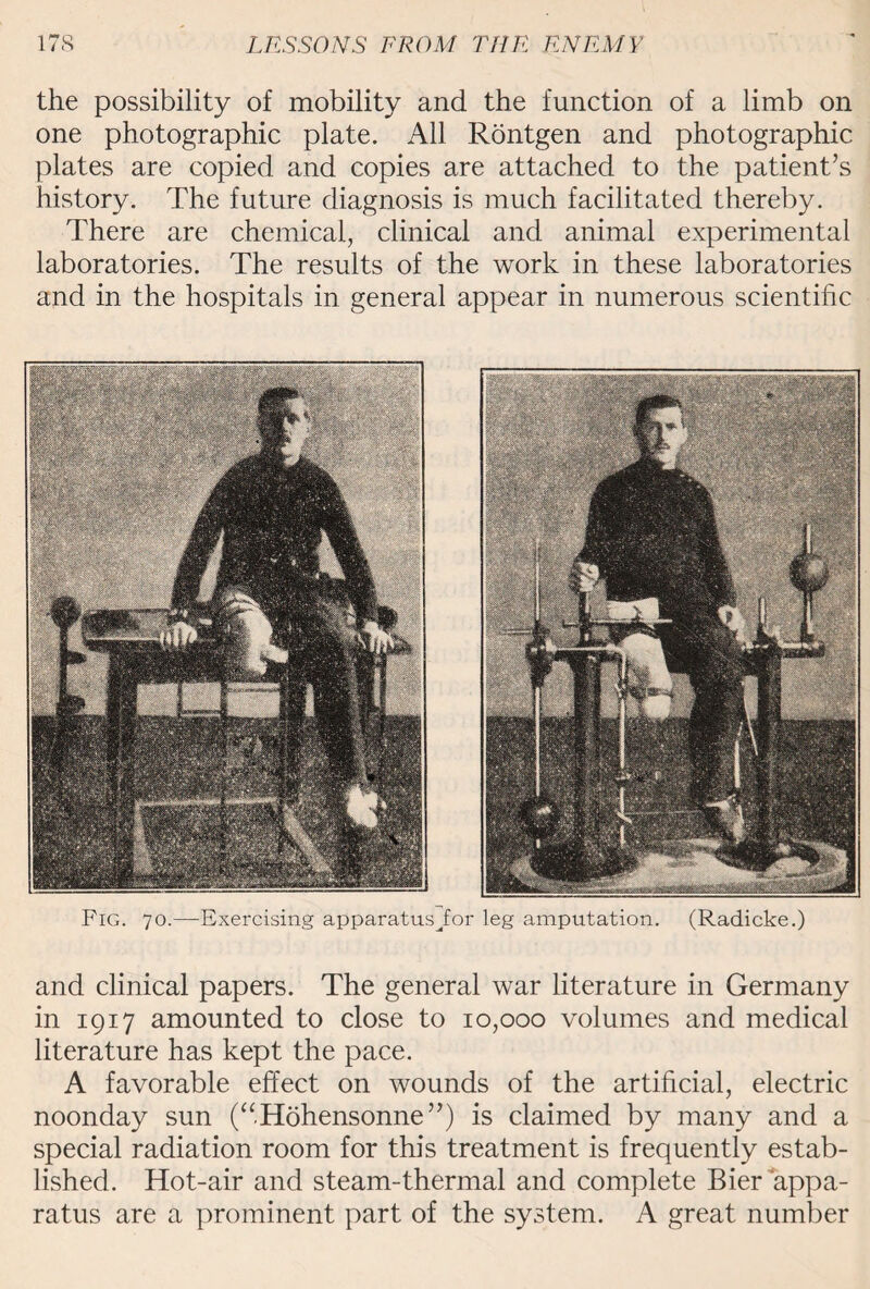 the possibility of mobility and the function of a limb on one photographic plate. All Rontgen and photographic plates are copied and copies are attached to the patient’s history. The future diagnosis is much facilitated thereby. There are chemical, clinical and animal experimental laboratories. The results of the work in these laboratories and in the hospitals in general appear in numerous scientific and clinical papers. The general war literature in Germany in 1917 amounted to close to 10,000 volumes and medical literature has kept the pace. A favorable effect on wounds of the artificial, electric noonday sun (“Hohensonne”) is claimed by many and a special radiation room for this treatment is frequently estab¬ lished. Hot-air and steam-thermal and complete Bier appa¬ ratus are a prominent part of the system. A great number