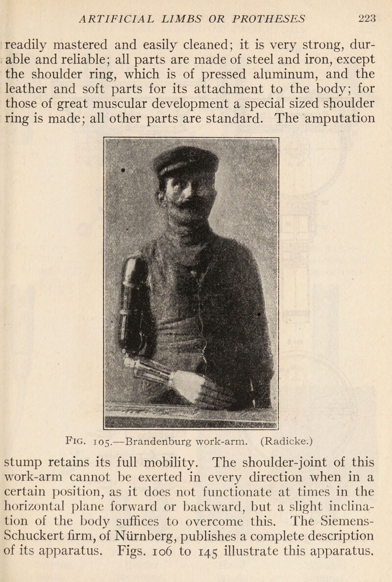 readily mastered and easily cleaned; it is very strong, dur¬ able and reliable; all parts are made of steel and iron, except the shoulder ring, which is of pressed aluminum, and the leather and soft parts for its attachment to the body; for those of great muscular development a special sized shoulder ring is made; all other parts are standard. The amputation Fig. 105.—Brandenburg work-arm. (Radicke.) stump retains its full mobility. The shoulder-joint of this work-arm cannot be exerted in every direction when in a certain position, as it does not functionate at times in the horizontal plane forward or backward, but a slight inclina¬ tion of the body suffices to overcome this. The Siemens- Schuckert firm, of Ntirnberg, publishes a complete description of its apparatus. Figs. 106 to 145 illustrate this apparatus.