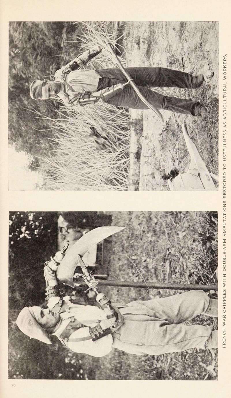 FRENCH WAR CRIPPLES WITH DOUBLE-ARM AMPUTATIONS RESTORED TO USEFULNESS AS AGRICULTURAL WORKERS.